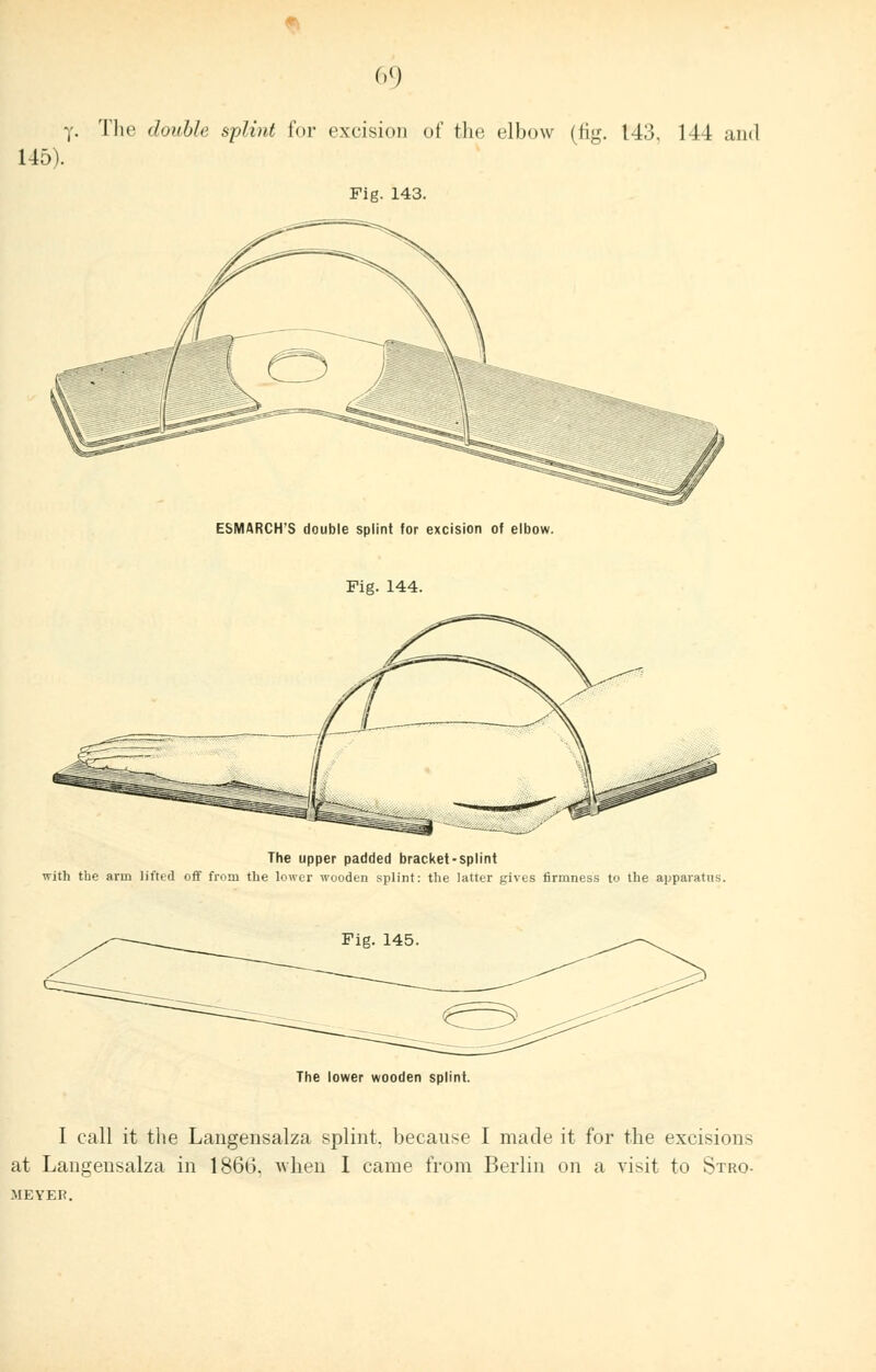 145). Fig. 143. ESMARCH'S double splint for excision of elbow. Fig. 144. The upper padded bracket-splint with the arm lifted off from the lower wooden splint: the latter gives firmness to the apparatus. Fig. 145. The lower wooden splint. I call it the Langensalza splint, because I made it for the excisions at Langensalza in 1866. when I came from Berlin on a visit to Stro- MEYER.