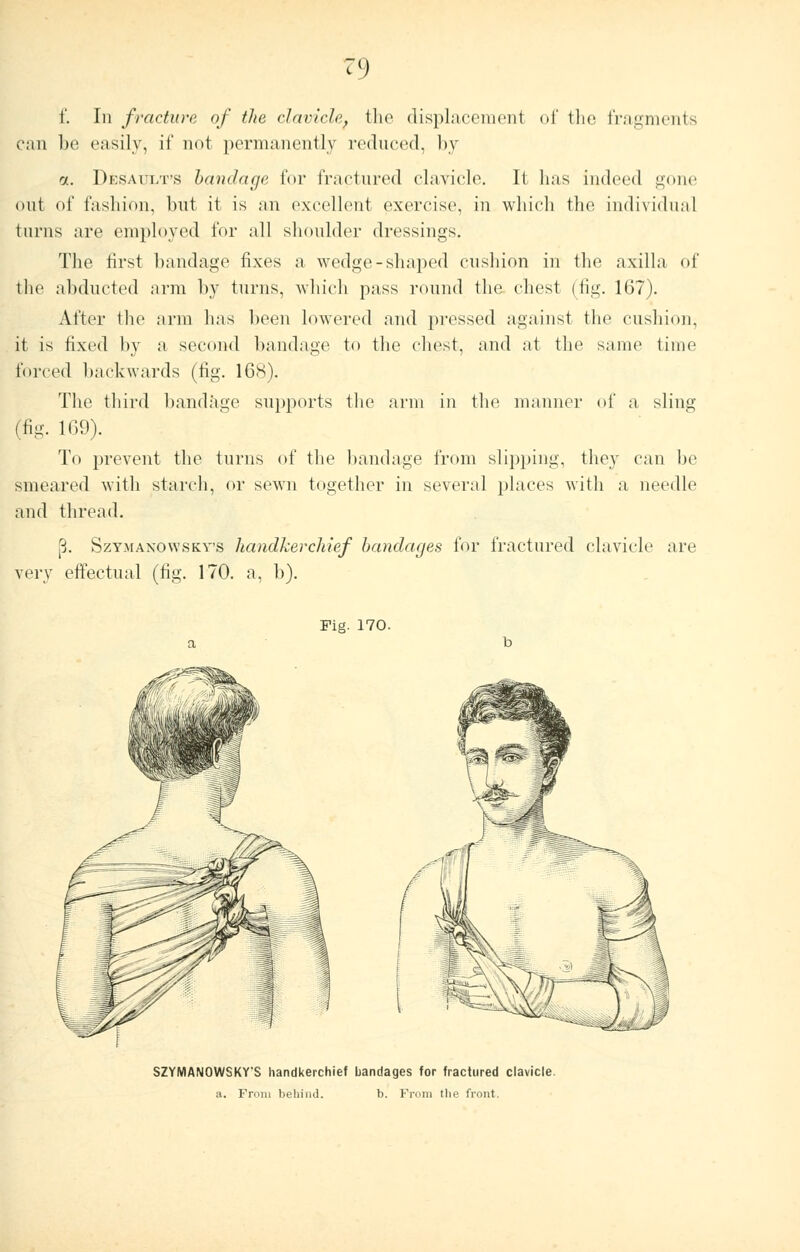 f. In fracture of the clavicle, the displacement of the fragments can be easily, if not permanently reduced, by ot. Desaoxt's bandage for fractured clavicle. It has indeed gone tint of fashion, but it is an excellent exercise, in which the individual turns are employed for all shoulder dressings. The first bandage fixes a wedge-shaped cushion in the axilla of the abducted arm by turns, which pass round the chest (fig. 167). After the arm has been lowered and pressed against the cushion, it is fixed by a second bandage to the chest, and at the same time forced backwards (tig. 168). The third bandage supports the arm in the manner of a sling (tig. 169). To prevent the turns of the bandage from slipping, they can he smeared with starch, or sewn together in several places with a needle and thread. {3. Szymanovvsky's handkerchief bandages for fractured clavicle are very effectual (fig. 170. a, b). Fig. 170. SZYMANOWSKVS handkerchief bandages for fractured clavicle. ;i. Frnm behind. b. From the front.