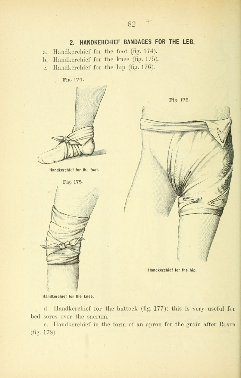 2. HANDKERCHIEF7 BANDAGES FOR THE LEG. a. Handkerchief for the foot (fig. 174). b. Handkerchief for the knee (fig. 175). c. Handkerchief for the hip (fig. 176). Fig. 174. Fig- 176. Handkerchief for the foot. Fig. 175. Handkerchief for the knee. Handkerchief for the hip. d. Handkerchief for the buttock (fig. 177): this is very useful for bed sores over the sacrum. e. Handkerchief in the form of an apron for the groin after Roser (fig. 178).