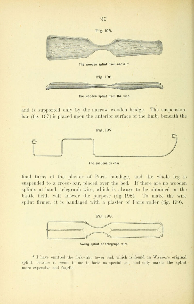 The wooden splint from above.* Fig. 196. The wooden splint from the side. and is supported only by the narrow wooden bridge. The suspension- bar (fig. 197) is placed upon the anterior surface of the limb, beneath the Fig. 197. The suspension-bar. final turns of the plaster of Paris bandage, and the whole leg is suspended to a cross - bar, placed over the bed. If there are no wooden splints at hand, telegraph wire, which is always to be obtained on the battle field, will answer the purpose (tig. 198). To make the wire splint firmer, it is bandaged with a plaster of Paris roller (fig. 199). Fig. 198. Swing splint of telegraph wire. * I have omitted the fork-like lower end. which is found in Watsons original splint, because it seems to me to have no special use, and only makes the splint more expensive and fragile.