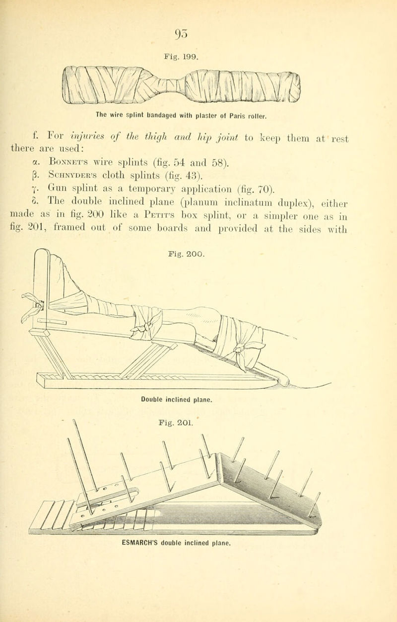 Fig. 199. The wire splint bandaged with plaster ot Paris roller. f. For injuries of the thigh and hip joint to keep them at rest there are used: a. Bonnet's wire splints (fig. 54 and 58). (3. SCHNYDER'S cloth Splints (fig. 43). 7. Gun splint as a temporary application (fig. 70). o. The double inclined plane (planum inclinatum duplex), either made as in fig. 200 like a Petite box splint, or a simpler one as in fig. 201, framed out of some boards and provided at the sides with Fig. 200. Double inclined plane. Fig. 201. ESMARCH'S double inclined plane.