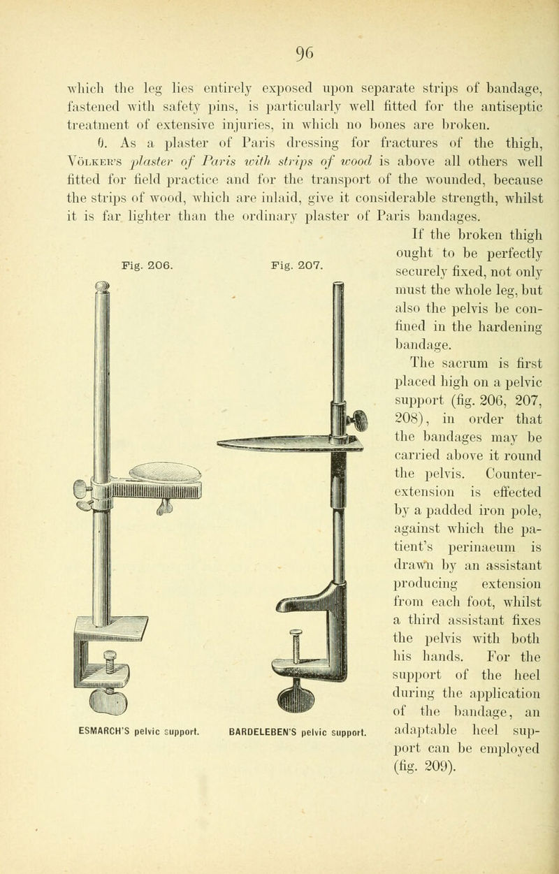 Fig. 206. Fig. 207. which the leg lies entirely exposed upon separate strips of bandage, fastened with safety pins, is particularly well fitted for the antiseptic treatment of extensive injuries, in which no bones are broken. 8. As a plaster of Paris dressing for fractures of the thigh, Volker's plaster of Paris with, strips of icood is above all others well fitted for field practice and for the transport of the wounded, because the strips of wood, which are inlaid, give it considerable strength, whilst it is far lighter than the ordinary plaster of Paris bandages. If the broken thigh ought to be perfectly securely fixed, not only must the whole leg, but also the pelvis be con- fined in the hardening bandage. The sacrum is first placed high on a pelvic support (fig. 206, 207, 208), in order that the bandages may be carried above it round the pelvis. Counter- extension is effected by a padded iron pole, against which the pa- tient's perinaeum is drawn by an assistant producing extension from each foot, whilst a third assistant fixes the pelvis with both his hands. For the support of the heel during the application of the bandage, an a d;i] (table heel sup- port can be employed (fig. 209). ESMARCH'S pelvic support. BARDELEBENS pelvic support.