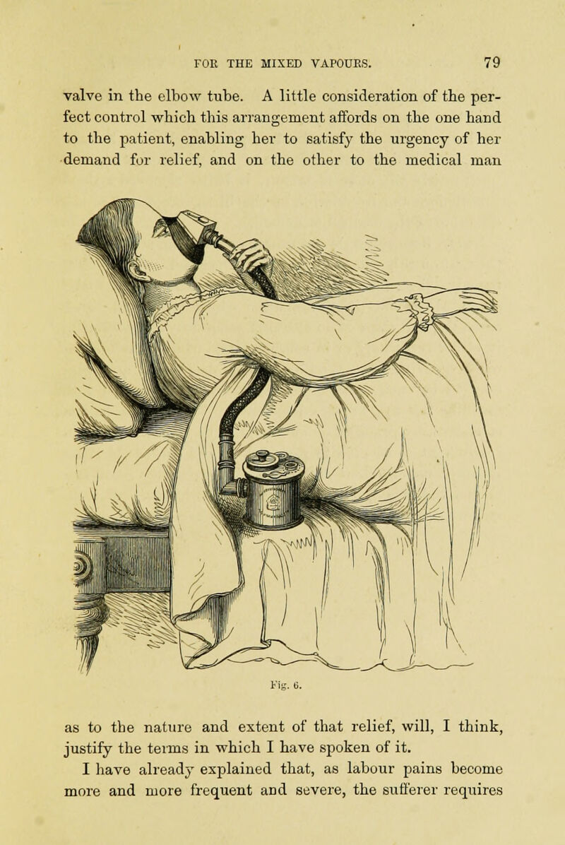 valve in the elbow tube. A little consideration of the per- fect control which this arrangement affords on the one hand to the patient, enabling her to satisfy the urgency of her demand for relief, and on the other to the medical man as to the nature and extent of that relief, will, I think, justify the terms in which I have spoken of it. I have already explained that, as labour pains become more and more frequent and severe, the sufferer requires