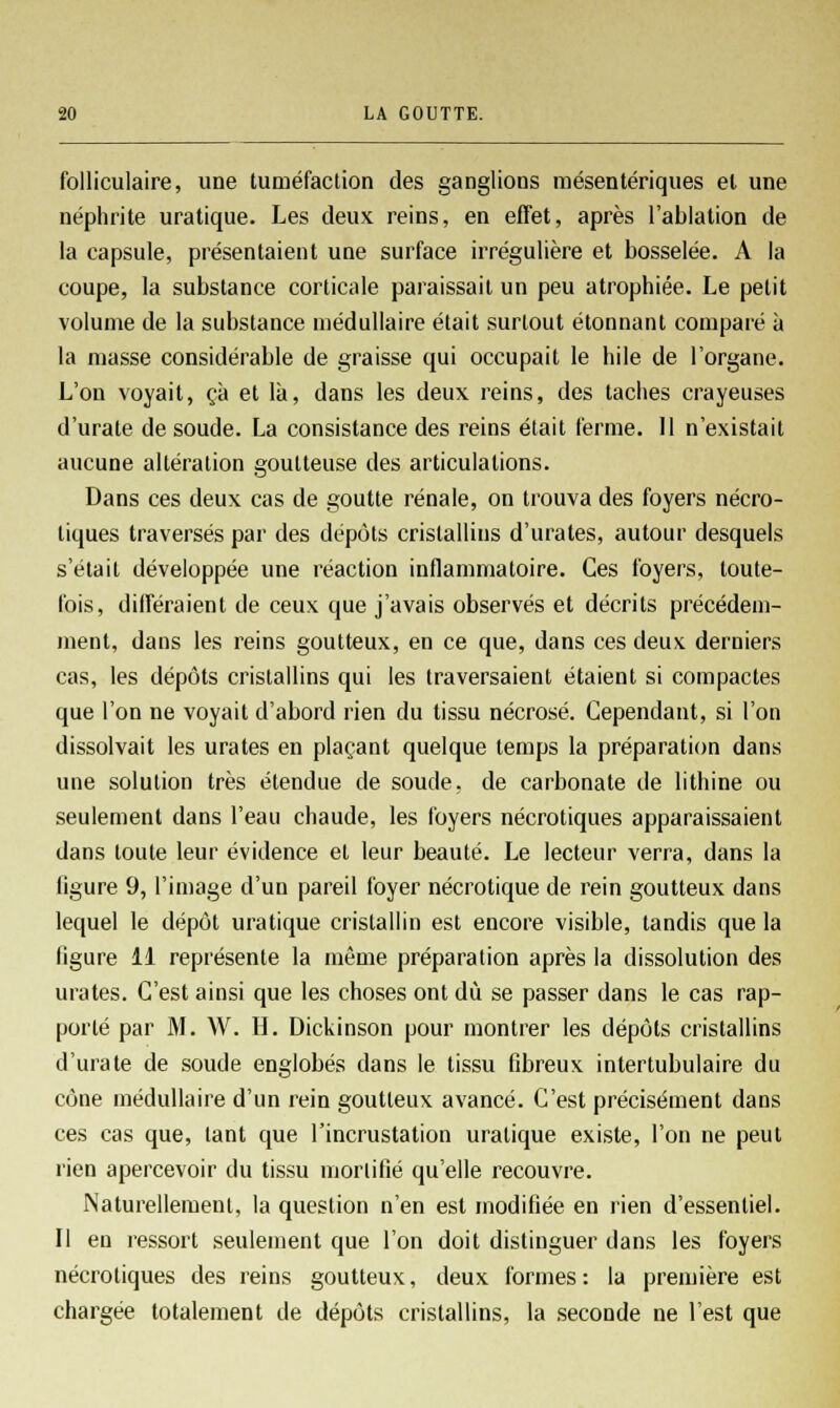 folliculaire, une tuméfaction des ganglions mésentériques et une néphrite uratique. Les deux reins, en effet, après l'ablation de la capsule, présentaient une surface irrégulière et bosselée. A la coupe, la substance corticale paraissait un peu atrophiée. Le petit volume de la substance médullaire était surtout étonnant comparé à la masse considérable de graisse qui occupait le hile de l'organe. L'on voyait, ça et là, dans les deux reins, des taches crayeuses d'urate de soude. La consistance des reins était ferme. 11 n'existait aucune altération goutteuse des articulations. Dans ces deux cas de goutte rénale, on trouva des foyers nécro- tiques traversés par des dépôts cristallins d'urates, autour desquels s'était développée une réaction inflammatoire. Ces foyers, toute- fois, différaient de ceux que j'avais observés et décrits précédem- ment, dans les reins goutteux, en ce que, dans ces deux derniers cas, les dépôts cristallins qui les traversaient étaient si compactes que l'on ne voyait d'abord rien du tissu nécrosé. Cependant, si l'on dissolvait les urates en plaçant quelque temps la préparation dans une solution très étendue de soude, de carbonate de lithine ou seulement dans l'eau chaude, les foyers nécrotiques apparaissaient dans toute leur évidence et leur beauté. Le lecteur verra, dans la ligure 9, l'image d'un pareil foyer nécrotique de rein goutteux dans lequel le dépôt uratique cristallin est encore visible, tandis que la ligure 11 représente la même préparation après la dissolution des urates. C'est ainsi que les choses ont dû se passer dans le cas rap- porté par M. W. H. Dickinson pour montrer les dépôts cristallins d'urate de soude englobés dans le tissu fibreux intertubulaire du cône médullaire d'un rein goutteux avancé. C'est précisément dans ces cas que, lant que l'incrustation uratique existe, l'on ne peut rien apercevoir du tissu mortifié qu'elle recouvre. Naturellement, la question n'en est modifiée en rien d'essentiel. Il en ressort seulement que l'on doit distinguer dans les foyers nécrotiques des reins goutteux, deux formes: la première est chargée totalement de dépôts cristallins, la seconde ne l'est que