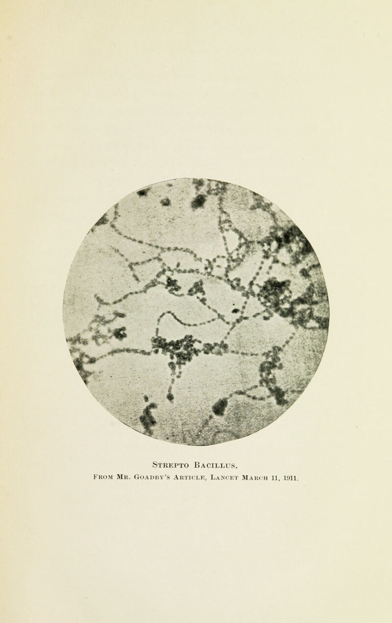 2 '<t***\%A. 7U» < .** >*%<* /^V---X/- N.*i^ Stkepto Bacillus. From Mr. Goadisy's Article, Lancet March 11, 1911.