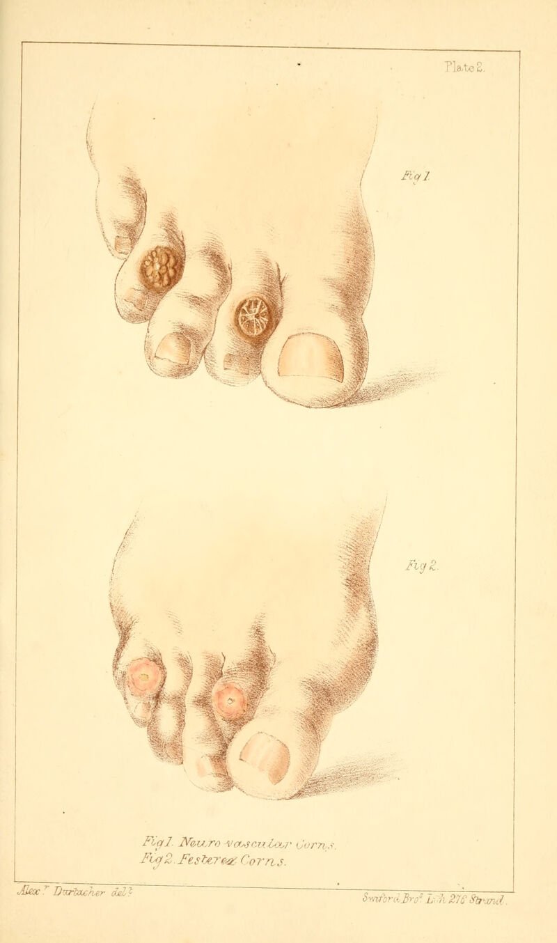 Kql ■ ' '*% Fial. N&vUro vouscuZoor Corns. FCq2.Fe.$'terea> Corn j. JJ&c1 Drxrfacher del? ttrcmd