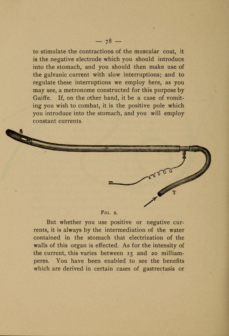 to stimulate the contractions of the muscular coat, it is the negative electrode which you should introduce into the stomach, and you should then make use of the galvanic current with slow interruptions; and to regulate these interruptions we employ here, as you may see, a metronome constructed for this purpose by Gaiffe. If, on the other hand, it be a case of vomit- ing you wish to combat, it is the positive pole which you introduce into the stomach, and you will employ constant currents. Fig. 2. But whether you use positive or negative cur- rents, it is always by the intermediation of the water contained in the stomach that electrization of the walls of this organ is effected. As for the intensity of the current, this varies between 15 and 20 milliam- peres. You have been enabled to see the benefits which are derived in certain cases of gastrectasis or