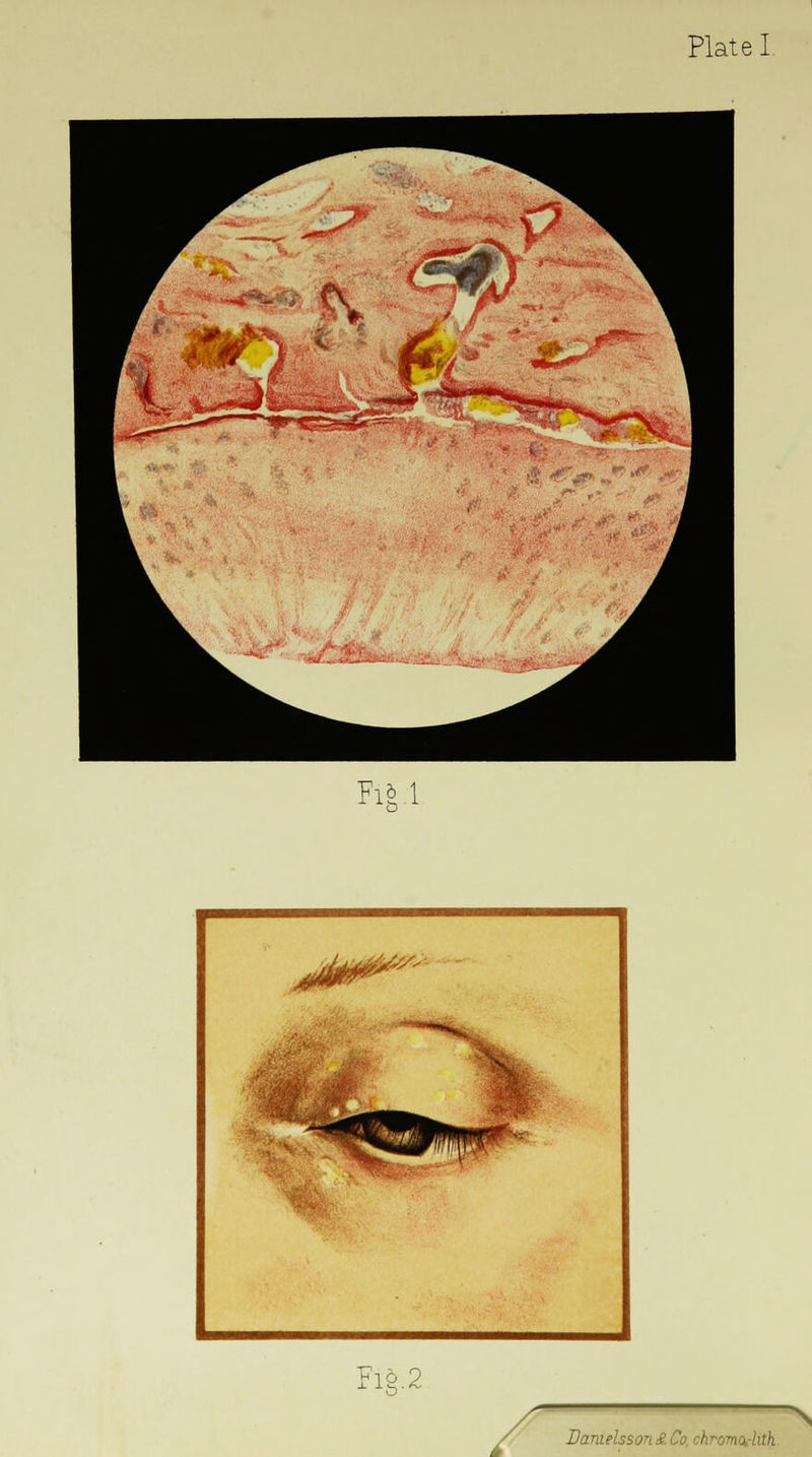 Plate I Fi«> 1 Fig.2 Damelsson & Co ch i m j /;//i