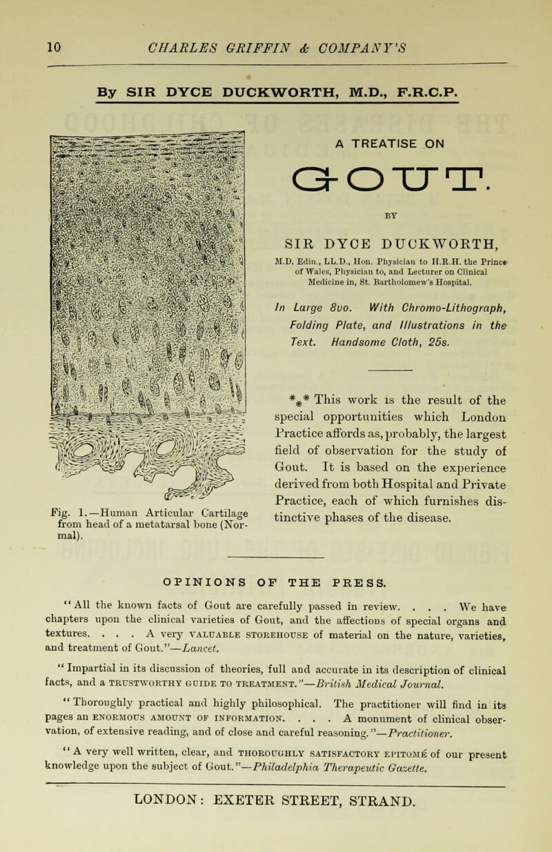 By SIR DYCE DUCKWORTH, M.D., F.R.C.P. Pt 3 i^W„ !m m '^PISS* Fig. 1.—Human Articular Cartilage from head of a metatarsal bone (Nor- mal). A TREATISE ON O-OTTT. SIR DYCE DUCKWORTH, M.D. Edin., LL.D., Hon. Physician to II.R.H. the Print* of Wales, Physician to, and Lecturer on Clinical Medicine in, St. Bartholomew's Hospital. In Large 8vo. With Chromo-Lithograph, Folding Plate, and Illustrations in the Text. Handsome Cloth, 25s. *#* This work is the result of the special opportunities which London Practice affords as, probably, the largest field of observation for the study of Gout. It is based on the experience derived from both Hospital and Private Practice, each of which furnishes dis- tinctive phases of the disease. OPINIONS OP THE PRESS.  All the known facts of Gout are carefully passed in review. . . . We have chapters upon the clinical varieties of Gout, and the affections of special organs and textures. ... A very valuable storehouse of material on the nature, varieties, and treatment of Gout.—Lancet.  Impartial in its discussion of theories, full and accurate in its description of clinical facts, and a trustworthy gdide to treatment.—British Medical Journal. Thoroughly practical and highly philosophical. The practitioner will find in its pages an enormous amount of information. ... A monument of clinical obser- vation, of extensive reading, and of close and careful reasoning.—Practitioner. A very well written, clear, and thoroughly satisfactory epitome of our present knowledge upon the subject of Gout.—Philadelphia Therapeutic Gazette.
