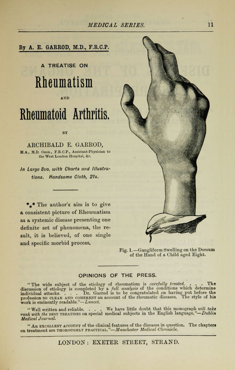 By A. E. GARROD, M.D., F.R.C.P. A TREATISE ON Rheumatism AND Rheumatoid Arthritis. AKCHIBALD E. GARROD, M.A., M.D. Oxon., F.R.C.P., Assistant-Physician to the West London Hospital, &c. In Large 8vo, with Charts and Illustra- tions. Handsome Cloth, 21s. *#* The author's aim is to give a consistent picture of Rheumatism as a systemic disease presenting one definite set of phenomena, the re- sult, it is believed, of one single and specific morbid process. Fig. 1.—Gangliform Swelling on the Dorsum of the Hand of a Child aged Eight. OPINIONS OF THE PRESS. The wide subject of the etiology of rheumatism is carefully treated. . . . The discussion of etiology is completed by a full analysis of the conditions which determine individual attacks. . . . Dr. Garrod is to be congratulated on having put before the profession so clear and coherent an account of the rheumatic diseases. The style of his work is eminently readable.—Lancet. Well written and reliable. . . . We have little doubt that this monograph wilt take rank with the best treatises on special medical subjects in the English language.—Dublin Medical Journal. An excellent account of the clinical features of the diseases in question. on treatment are thoroughly practical.—Manchester Medical Chronicle. The chapters