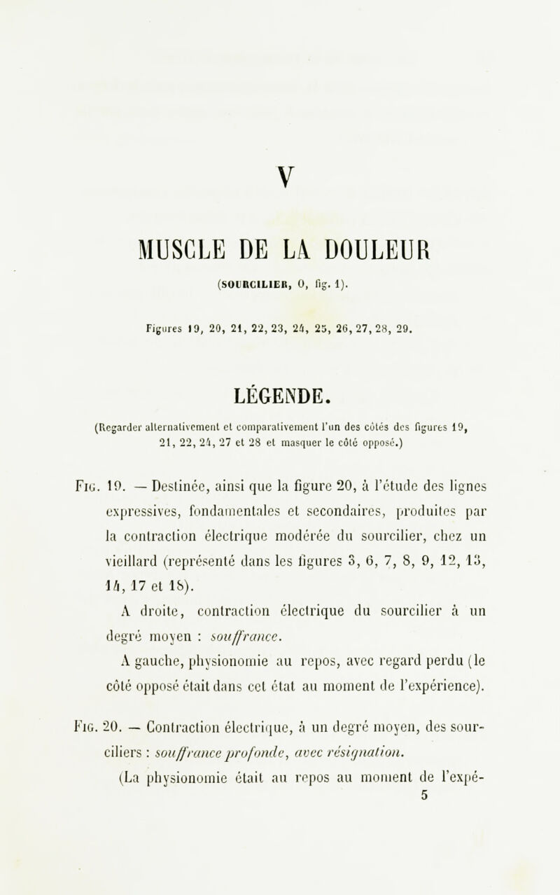 MUSCLE DE LA DOULEUR (SOURCILIER, 0, fig. 1). Figures 19, 20, 21, 22, 23, 24, 25, 2(5, 27, 28, 29. LEGENDE. (Regarder alternativement el comparativement l'un des cotés des figures 19, 21, 22, 24, 27 et 28 et masquer le côté opposé.) Fiu. 19. — Destinée, ainsi que la figure 20, à l'étude des lignes expressives, fondamentales et secondaires, produites par la contraction électrique modérée du sourcilier, chez un vieillard (représenté dans les figures 3, 6, 7, 8, 9, 12, 13, \l\, 17 et lb). A droite, contraction électrique du sourcilier à un degré moyen : souffrance. A gauche, physionomie au repos, avec regard perdu (le côté opposé était dans cet état au moment de l'expérience). Fig. 20. — Contraction électrique, à un degré moyen, des sour- ciliers : souffrance profonde, avec résignation. (La physionomie était au repos au moment de l'expé- 5