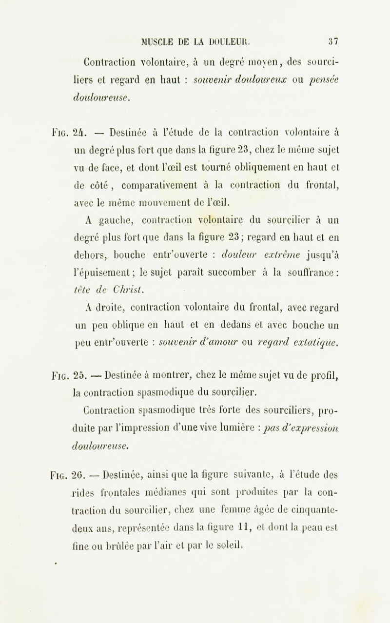 Contraction volontaire, à un degré moyen, des sourci- liers et regard en haut : souvenir douloureux ou pensée douloureuse. Fig. 24. — Destinée à l'étude de la contraction volontaire à un degré plus fort que dans la figure 23, chez le même sujet vu de face, et dont l'œil est tourné obliquement en haut et de côté , comparativement à la contraction du frontal, avec le même mouvement de l'œil. A gauche, contraction volontaire du sourcilier à un degré plus fort que dans la figure 23; regard en haut et en dehors, bouche entr'ouverte : douleur extrême jusqu'à l'épuisement ; le sujet parait succomber à la souffrance : tête de Christ. A droite, contraction volontaire du frontal, avec regard un peu oblique en haut et en dedans et avec bouche un peu entr'ouverte : souvenir d'amour ou regard extatique. Fig. 25. — Destinée à montrer, chez le même sujet vu de profil, la contraction spasmodique du sourcilier. Contraction spasmodique très forte des sourciliers, pro- duite par l'impression d'une vive lumière : pas d'expression douloureuse. Fig. 26. — Destinée, ainsi que la figure suivante, à l'étude des rides frontales médianes qui sont produites par la con- traction du sourcilier, chez une femme âgée de cinquante- deux ans, représentée dans la figure 11, et dont la peau est fine ou brûlée par l'air et par le soleil