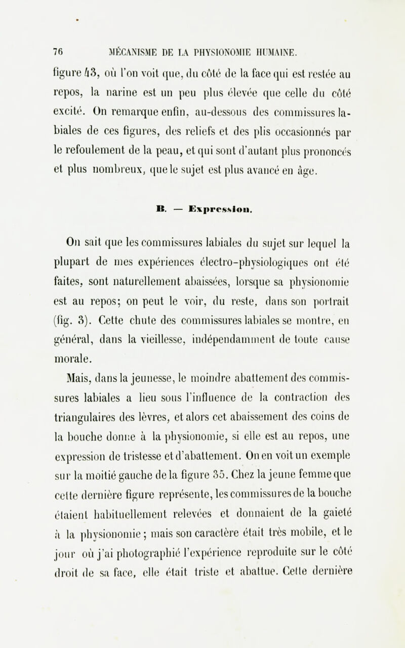 figure 63, où l'on voit que, du côté de la face qui est restée au repos, la narine est un peu plus élevée que celle du côté excité. On remarque enfin, au-dessous des commissures la- biales de ces figures, des reliefs et des plis occasionnés par le refoulement de la peau, et qui sont d'autant plus prononcés et plus nombreux, que le sujet est plus avancé en âge. B. — Expression. Ou sait que les commissures labiales du sujet sur lequel la plupart de mes expériences électro-physiologiques ont été faites, sont naturellement abaissées, lorsque sa physionomie est au repos; on peut le voir, du reste, dans son portrait (fig. 3). Cette chute des commissures labiales se montre, en général, dans la vieillesse, indépendamment de toute cause morale. Mais, dans la jeunesse, le moindre abattement des commis- sures labiales a lieu sous l'influence de la contraction des triangulaires des lèvres, et alors cet abaissement des coins de la bouche donne à la physionomie, si elle est au repos, une expression de tristesse et d'abattement. On en voit un exemple sur la moitié gauche de la figure 35. Chez la jeune femme que cette dernière figure représente, les commissures de la bouche étaient habituellement relevées et donnaient de la gaieté à la physionomie ; mais son caractère était très mobile, et le jour où j'ai photographié l'expérience reproduite sur le côté droit de sa face, elle était triste et abattue. Cette dernière