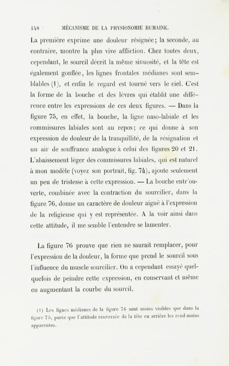 La première exprime une douleur résignée ; la seconde, au contraire, montre la plus vive affliction. Chez toutes deux, cependant, le sourcil décrit la même sinuosité, et la tête est également gonflée, les lignes frontales médianes sont sem- blables (1), et enfin le regard est tourné vers le ciel. C'est la forme de la bouche et des lèvres qui établit une diffé- rence entre les expressions de ces deux figures. — Dans la figure 75, en effet, la bouche, la ligne naso-labiale et les commissures labiales sont au repos; ce qui donne à son expression de douleur de la tranquillité, de la résignation et un air de souffrance analogue à celui des figures 20 et 21. L'abaissement léger des commissures labiales, qui est naturel à mon modèle (voyez son portrait, fig. 1k), ajoute seulement un peu de tristesse à cette expression. — La bouche entr'ou- verte, combinée avec la contraction du sourcilier, dans la figure 76, donne un caractère de douleur aiguë à l'expression de la religieuse qui y est représentée. A la voir ainsi clans cette attitude, il me semble l'entendre se lamenter. La figure 76 prouve que rien ne saurait remplacer, pour l'expression de la douleur, la forme que prend le sourcil sous l'influence du muscle sourcilier. On a cependant essayé quel- quefois de peindre cette expression, en conservant et même en augmentant la courbe du sourcil. (I) Les lignes médianes de la ligure 76 sont moins visibles que dans la ligure 75, parce que l'attitude renversée de la tète en arriére les rend moins apparentes.