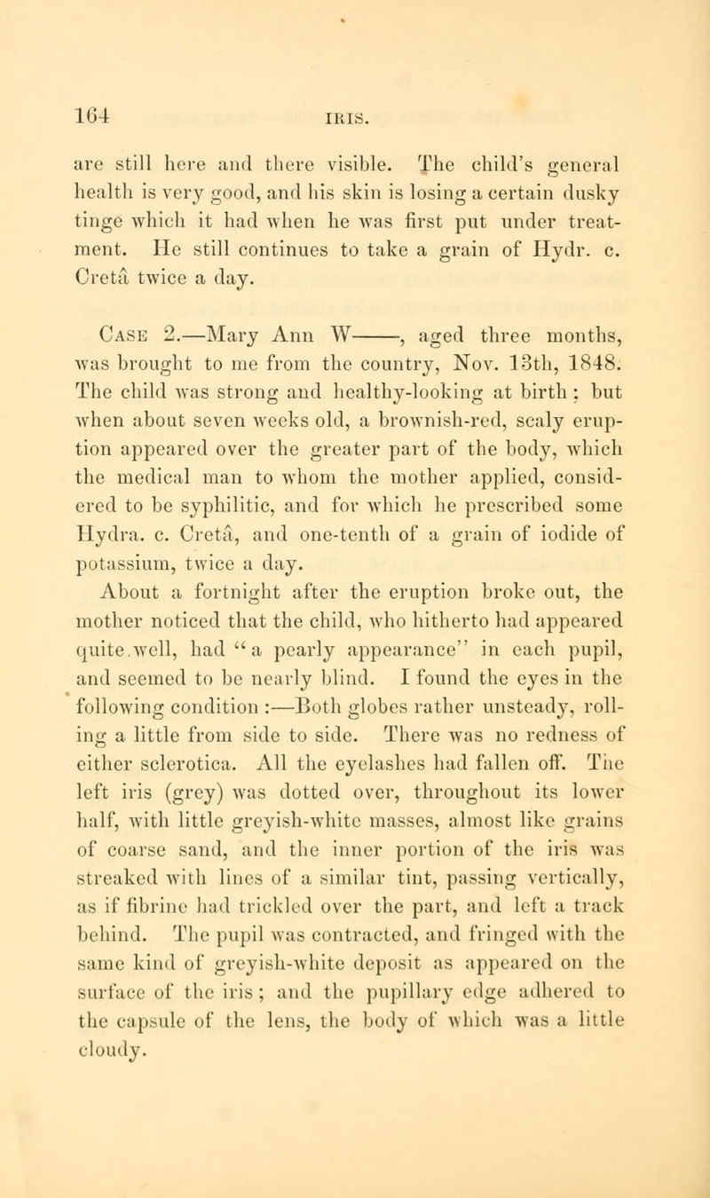 are still here and there visible. The child's general health is very good, and his skin is losing a certain dusky tinge which it had when he was first put under treat- ment. He still continues to take a grain of Hydr. c. Creta twice a day. Case 2.—Mary Ann W , aged three months, was brought to me from the country, Nov. 13th, 1848. The child was strong and healthy-looking at birth : but when about seven weeks old, a brownish-red, scaly erup- tion appeared over the greater part of the body, which the medical man to whom the mother applied, consid- ered to be syphilitic, and for which he prescribed some Hydra, c. Creta, and one-tenth of a grain of iodide of potassium, twice a day. About a fortnight after the eruption broke out, the mother noticed that the child, who hitherto had appeared quite.well, had a pearly appearance in each pupil, and seemed to be nearly blind. I found the eyes in the following condition :—Both globes rather unsteady, roll- ing a little from side to side. There was no redness of either sclerotica. All the eyelashes had fallen off. The left iris (grey) was dotted over, throughout its lower half, with little greyish-white masses, almost like grains of coarse sand, and the inner portion of the iris was streaked with lines of a similar tint, passing vertically, as if fibrine had trickled over the part, and left a track behind. The pupil was contracted, and fringed with the same kind of greyish-white deposit as appeared on the surface of the iris ; and the pupillary edge adhered to the capsule of the lens, the body of which was a little cloudy.