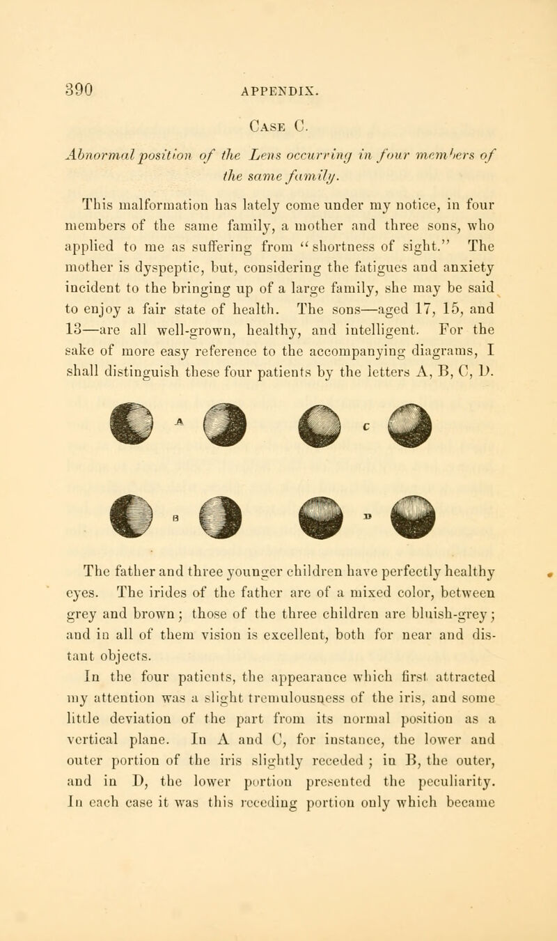 Case C. Abnormal position of the Lens occurring in four members of the same fam Hi/. This malformation has lately come under my notice, in four members of the same family, a mother and three sons, who applied to me as suffering from shortness of sight. The mother is dyspeptic, but, considering the fatigues and anxiety incident to the bringing up of a large family, she may be said to enjoy a fair state of health. The sons—aged 17, 15, and 13—are all well-grown, healthy, and intelligent. For the sake of more easy reference to the accompanying diagrams, I shall distinguish these four patients by the letters A, B, C, D. The father and three younger children have perfectly healthy eyes. The irides of the father are of a mixed color, between grey and brown; those of the three children are bluish-grey; and in all of them vision is excellent, both for near and dis- tant objects. In the four patients, the appearance which first attracted my attention was a slight tremulousness of the iris, and some little deviation of the part from its normal position as a vertical plane. In A and C, for instance, the lower and outer portion of the iris slightly receded ; in B, the outer, and in I), the lower portion presented the peculiarity. In each case it was this receding portion only which became