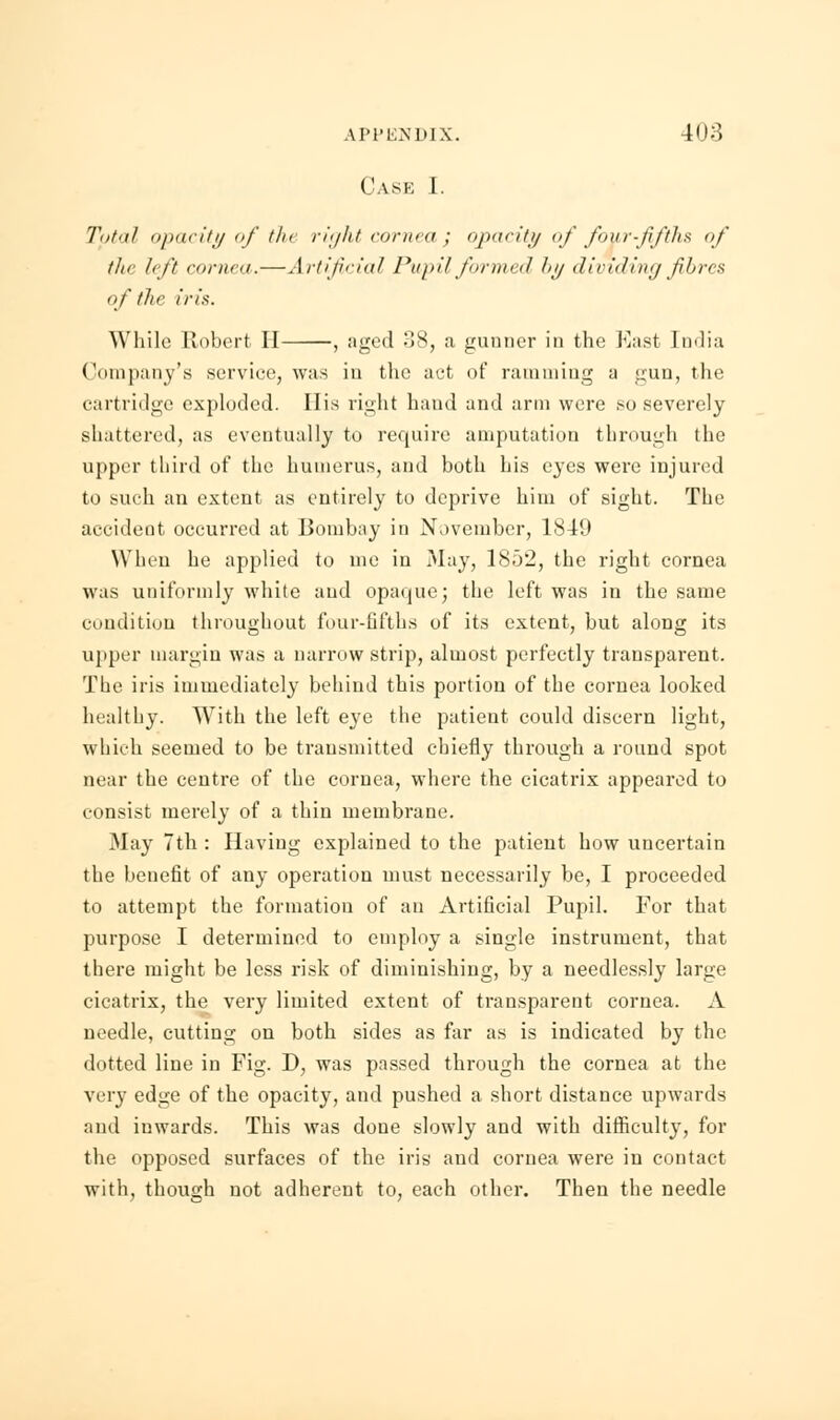 Case I. Total opacity of the right cornea ; opacity of four-fifths of the lift cornea.—Artificial Pupil formed by dividing fibres of the iris. While Robert II , aged 38, a gunner in the East India Company's service, was in the act of ramming a gun, the cartridge exploded. His right hand and arm were so severely shattered, as eventually to require amputation through the upper third of the humerus, and both his eyes were injured to Midi an extent as entirely to deprive him of sight. The accident occurred at Bombay in November, 1849 When he applied to me in May, 1852, the right cornea was uniformly white and opaque; the left was in the same condition throughout four-fifths of its extent, but along its upper margin was a narrow strip, almost perfectly transparent. The iris immediately behind this portion of the cornea looked healthy. With the left eye the patient could discern light, which seemed to be transmitted chiefly through a round spot near the centre of the cornea, where the cicatrix appeared to consist merely of a thin membrane. May 7th : Having explained to the patient how uncertain the benefit of any operation must necessarily be, I proceeded to attempt the formation of an Artificial Pupil. For that purpose I determined to employ a single instrument, that there might be less risk of diminishing, by a needlessly large cicatrix, the very limited extent of transparent cornea. A needle, cutting on both sides as far as is indicated by the dotted line in Fig. D, was passed through the cornea at the very edge of the opacity, and pushed a short distance upwards and inwards. This was done slowly and with difficulty, for the opposed surfaces of the iris and cornea were in contact with, though not adherent to, each other. Then the needle