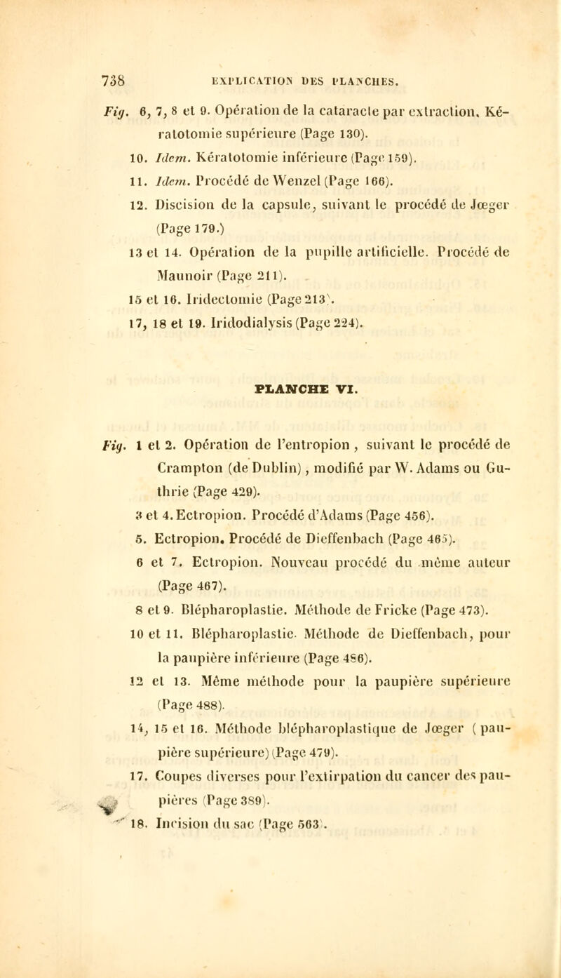 Fig. 6, 7, 8 et 9. Opération de la cataracte par extraction. Ké- ralotomie supérieure (Page 130). 10. Idem. Kéralotomie inférieure (Page 159). 11. Idem. Procédé de Wenzel (Page 166). 12. Discision de la capsule, suivant le procédé de Jœger (Page 179.) 13 et 14. Opération de la pupille artificielle. Procédé de Maunoir (Page 211). 15 et 16. Iridectoinie (Page2l3\ 17, 18 et 19. lridodialysis (Page 244). FLANCHE VI. Fig. 1 et 2. Opération de l'entropion , suivant le procédé de Crampton (de Dublin), modifié par W. Adams ou Gu- thrie (Page 429). 9 et 4. Ectropion. Procédé d'Adams (Page 456). 5. Ectropion. Procédé de Dieffenbach (Page 465). 6 et 7. Ectropion. Nouveau procédé du même auteur (Page 467). 8 et 9. Blépharoplastie. Méthode de Fricke (Page 473). 10 et 11. Blépharoplastie- Méthode de Dieffenbach, pour la paupière inférieure (Page 4S6). Î2 et 13. Même méthode pour la paupière supérieure (Page 488). 14; 15 et 16. Méthode blépharoplastiquc de Jœger (pau- pière supérieure) (Page 479). 17. Coupes diverses pour l'extirpation du cancer des pau- pières (Page 389). 18. Incision du sac (Page 563 .