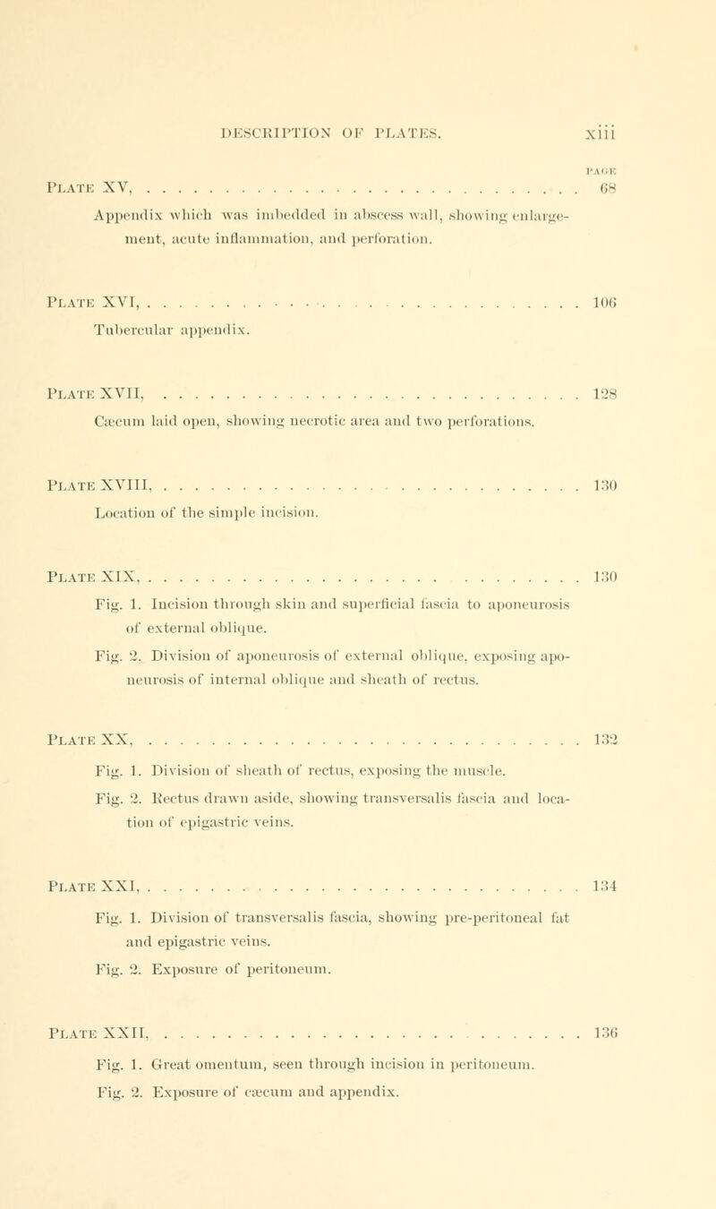 Plate XV 68 Appendix which was imbedded in abscess wall, showing enlarge- ment, acute inflammation, and perforation. Plate XVI, 106 Tubercular appendix. Plate XVII, 128 Caecum laid open, showing necrotic area and two perforations. Plate XVIII, 130 Location of the simple incision. Plate XIX 130 Fig. 1. Incision through skin and superficial fascia to aponeurosis of external oblique. Fig. 2. Division of aponeurosis of external oblique, exposing apo- neurosis of internal oblique and sheath of rectus. Plate XX 132 Fig. 1. Division of sheath of rectus, exposing the muscle. Fig. 2. Kectus drawn aside, showing transversalis fascia and loca- tion of epigastric veins. Plate XXI 134 Fig. 1. Division of transversalis fascia, showing pre-peritoneal fat and epigastric veins. Fig. 2. Exposure of peritoneum. Plate XXII 136 Fig. 1. Great omentum, seen through incision in peritoneum. Fig. 2. Exposure of caecum and appendix.