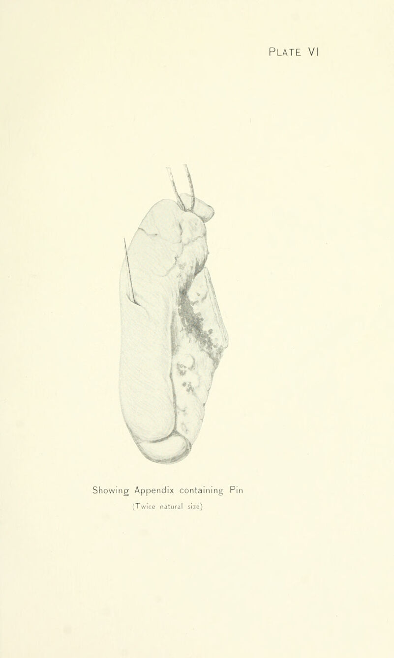 Showing Appendix containing Pin (Twice natural size)