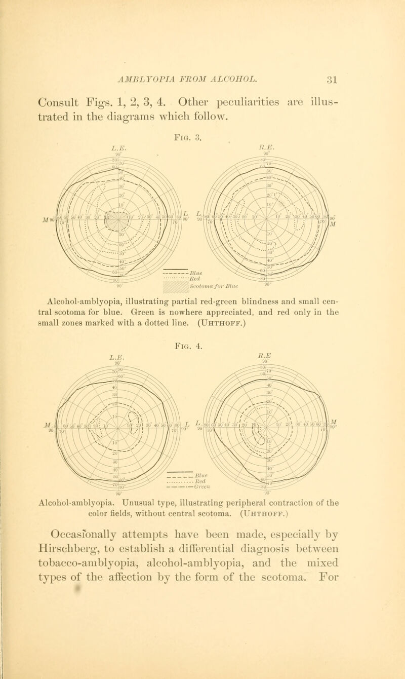 Consult Figs. 1, 2, 3, 4. Other peculiarities are illus- trated in the diagrams which follow. Fig. 3. * forth* Alcohol-amblyopia, illustrating partial red-green blindness and small cen- tral scotoma for blue. Green is nowhere appreciated, and red only in the small zones marked with a dotted line. (Uhthoff.) Fig. 4. L.E /,'. E Alcohol-amblyopia. Unusual type, illustrating peripheral contraction of the color fields, without central scotoma. (Uhthoff.) Occasionally attempts have been made, especially by Hirschberg, to establish a differential diagnosis between tobaeco-ambtyopia, alcohol-amblyopia, and the mixed types of the affection by the form of the scotoma. For