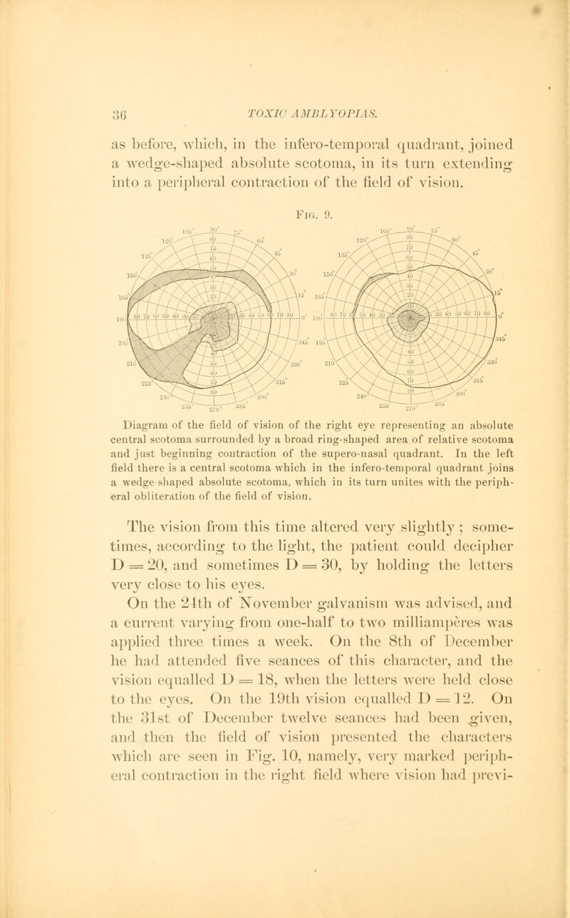 as before, which, in the infero-temporal quadrant, joined a wedge-shaped absolute scotoma, in its turn extending into a peripheral contraction of the field of vision. Fig. 9. Diagram of the field of vision of the right eye representing an absolute central scotoma surrounded by a broad ring-shaped area of relative scotoma and just beginning contraction of the supero-nasal quadrant. In the left field there is a central scotoma which in the infero-temporal quadrant joins a wedge shaped absolute scotoma, which in its turn unites with the periph- eral obliteration of the field of vision. The vision from this time altered very slightly; some- times, according to the light, the patient could decipher D = 20, and sometimes D = 30, by holding the letters very close to his eyes. On the 24th of November galvanism was advised, and a current varying from one-half to two milliamperes was applied three times a week. On the 8th of December he had attended five seances of this character, and the vision equalled D = 18, when the letters were held close to the eyes. On the 19th vision equalled D = 12. On the 31st of December tAvelve seances had been given, and then the field of vision presented the characters which are seen in Fig. 10, namely, very marked periph- eral contraction in the right field where vision had previ-