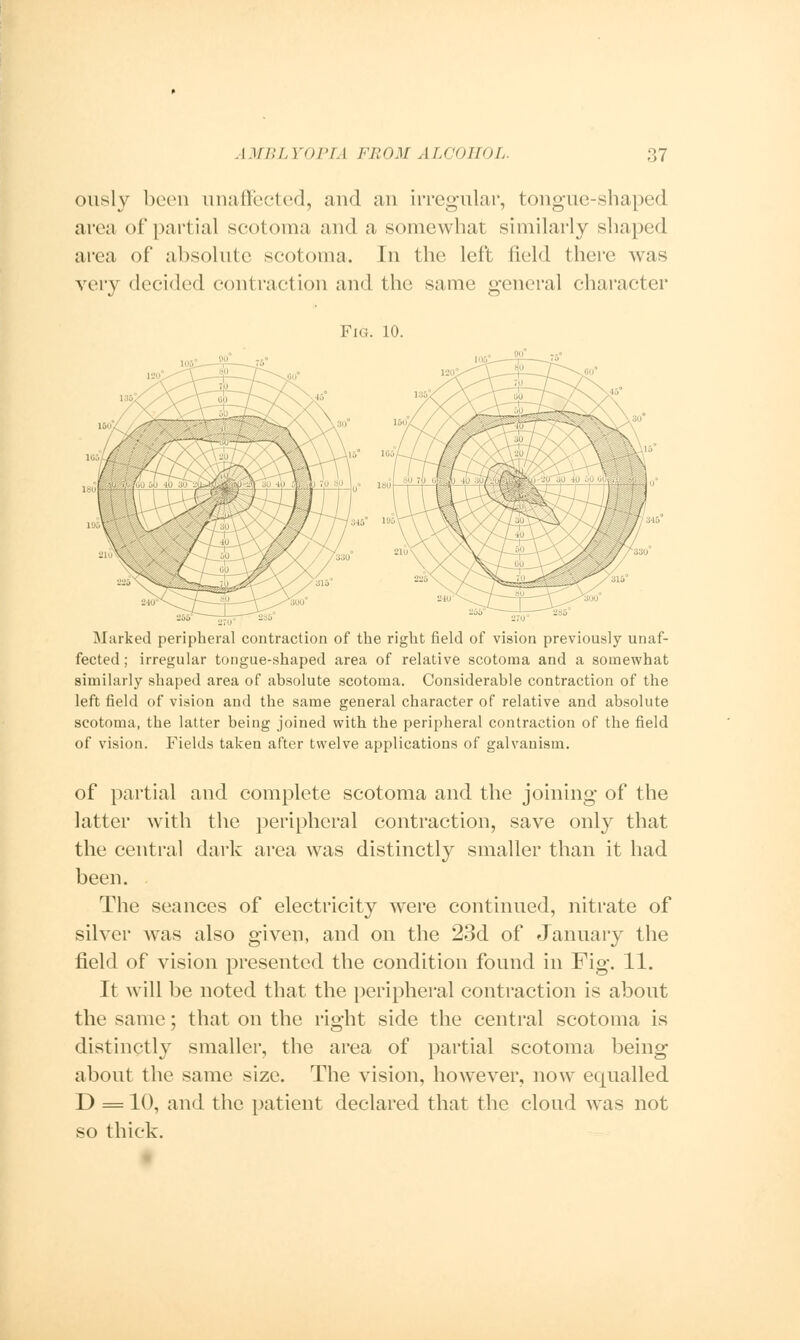 ously been unaffected, and an irregular, tongue-shaped area of partial scotoma and a somewhat similarly shaped area of absolute scotoma. In the left field there was very decided contraction and the same general character Fig. 10. Marked peripheral contraction of the right field of vision previously unaf- fected ; irregular tongue-shaped area of relative scotoma and a somewhat similarly shaped area of absolute scotoma. Considerable contraction of the left field of vision and the same general character of relative and absolute scotoma, the latter being joined with the peripheral contraction of the field of vision. Fields taken after twelve applications of galvanism. of partial and complete scotoma and the joining of the latter with the peripheral contraction, save only that the central dark area was distinctly smaller than it had been. The seances of electricity were continued, nitrate of silver was also given, and on the 23d of January the field of vision presented the condition found in Fig. 11. It will be noted that the peripheral contraction is about the same; that on the right side the central scotoma is distinctly smaller, the area of partial scotoma being about the same size. The vision, however, now equalled D = 10, and the patient declared that the cloud was not so thick.