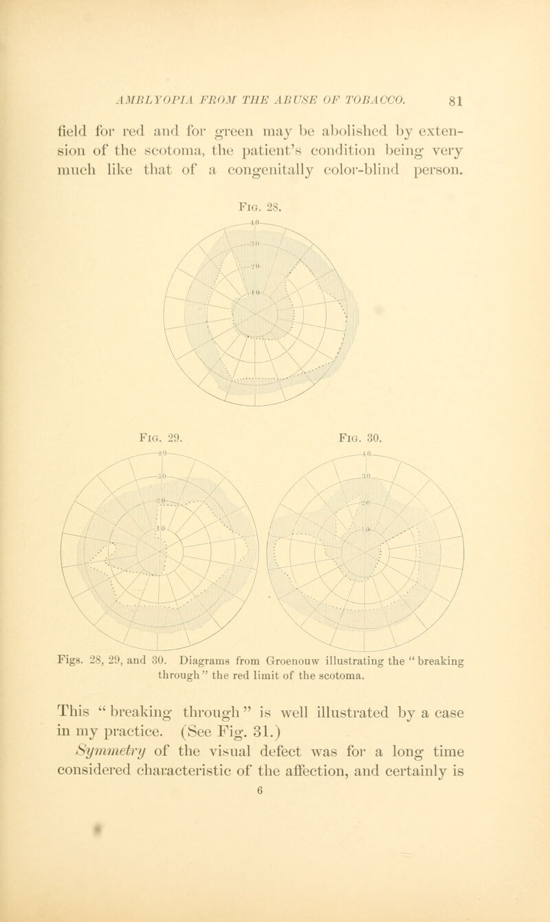 field for red and for green may be abolished by exten- sion of the scotoma, the patient's condition being very much like that of a congenitally color-blind person. Fig. 28. Fig. 29. Fig. 30. Figs. 28, 29, and 30. Diagrams from Groenouw illustrating the  breaking through the red limit of the scotoma. This  breaking through  is well illustrated by a case in my practice. (See Fig. 31.) Symmetry of the visual defect was for a long time considered characteristic of the affection, and certainly is 6