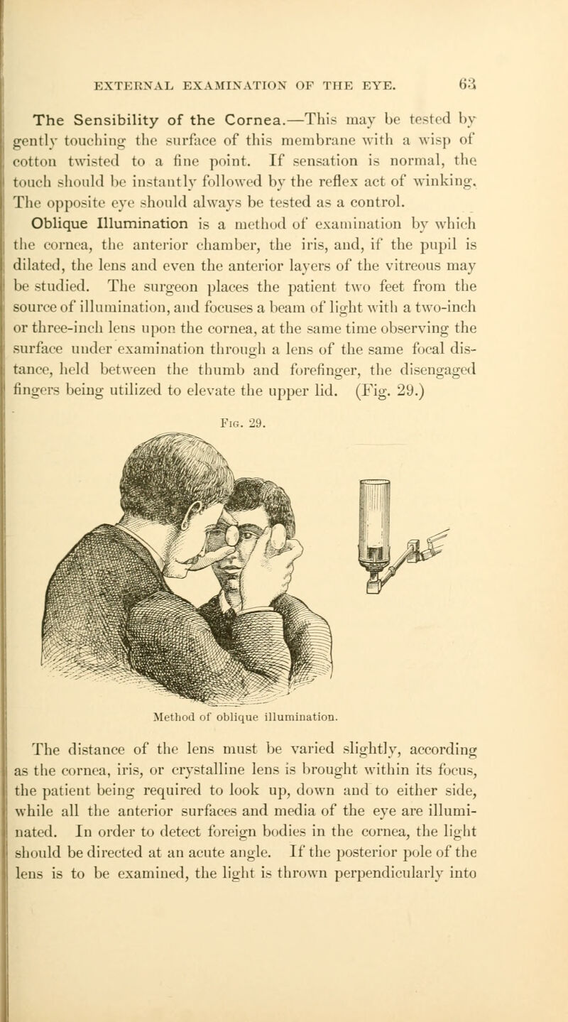 The Sensibility of the Cornea.—This may be tested by gently touching the surface of this membrane with a wisp of cotton twisted to a fine point. If sensation is normal, the touch should be instantly followed by the reflex act of winking. The opposite eye should always be tested as a control. Oblique Illumination is a method of examination by which the cornea, the anterior chamber, the iris, and, if the pupil is dilated, the lens and even the anterior layers of the vitreous may be studied. The surgeon places the patient two feet from the source of illumination, and focuses a beam of light with a two-inch or three-inch lens upon the cornea, at the same time observing the surface under examination through a lens of the same focal dis- tance, held between the thumb and forefinger, the disengaged fingers being utilized to elevate the upper lid. (Fig. 29.) Fig. 29. Method of oblique illumination. The distance of the lens must be varied slightly, according as the cornea, iris, or crystalline lens is brought within its focus, the patient being required to look up, down and to either side, while all the anterior surfaces and media of the eye are illumi- nated. In order to detect foreign bodies in the cornea, the light should be directed at an acute angle. If the posterior pole of the lens is to be examined, the light is thrown perpendicularly into