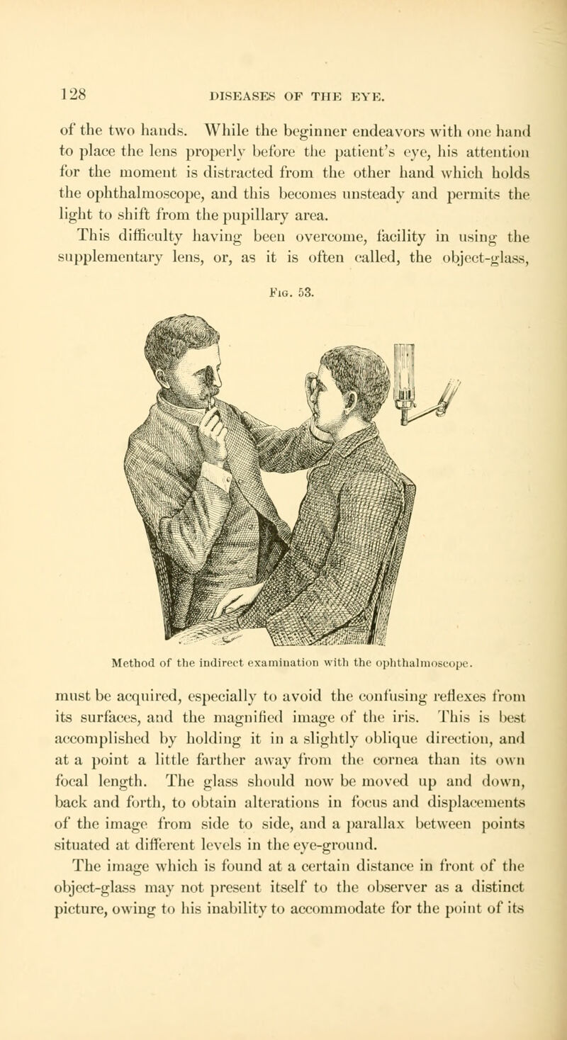 of the two hands. While the beginner endeavors with one hand to place the lens properly before the patient's eye, his attention for the moment is distracted from the other hand which holds the ophthalmoscope, and this becomes unsteady and permits the light to shift from the pupillary area. This difficulty having been overcome, facility in using the supplementary lens, or, as it is often called, the object-glass, Fig. 53. Method of the indirect examination with the ophthalmoscope. must be acquired, especially to avoid the confusing reflexes from its surfaces, and the magnified image of the iris. This is beat accomplished by holding it in a slightly oblique direction, and at a point a little farther away from the cornea than its own focal length. The glass should now be moved up and down, back and forth, to obtain alterations in focus and displacements of the image from side to side, and a parallax between points situated at different levels in the eye-ground. The image which is found at a certain distance in front of the object-glass may not present itself to the observer as a distinct picture, owing to his inability to accommodate for the point of its