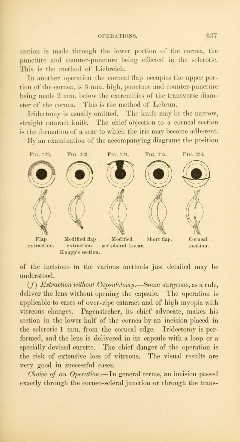 sectioo is made through the lower portion of the cornea, the puncture and counter-puncture being effected in the sclerotic. This is the method of Liebreich. In another operation the corneal Hap occupies the upper por- tion of the cornea, is •> nun. high, puncture and counter-puncture being made 2 nun. below the extremities of the transverse diam- eter of the cornea. This is the method of Lebrun. Iridectomy is usually omitted. The knife may be the narrow, straight cataract knife. The chief objection to a corneal section is the formation of a scar to which the iris may become adherent. By an examination of the accompanying diagrams the position Fig. 222. Fig. 22:?. Fig. -2-2i. Fig. 225. Fig. 226. Flap Modified flap Modified Short flap, extraction. extraction. peripheral linear. Knapp's section. of the incisions in the various methods just detailed may be understood. (/) Extraction ivithout Capsulotomy.—Some surgeons, as a rule, deliver the lens without opening the capsule. The operation is applicable to cases of over-ripe cataract and of high myopia with vitreous changes. Pagenstecher, its chief advocate, makes his section in the lower half of the cornea by an incision placed in the sclerotic 1 mm. from the corneal edge. Iridectomy is per- formed, and the lens is delivered in its capsule with a loop or a specially devised curette. The chief danger of the operation is the risk of extensive loss of vitreous. The visual results are very good in successful cases. ('/toiee of an Operation.—In general terms, an incision passed exactly through the corneo-scleral junction or through the trans-