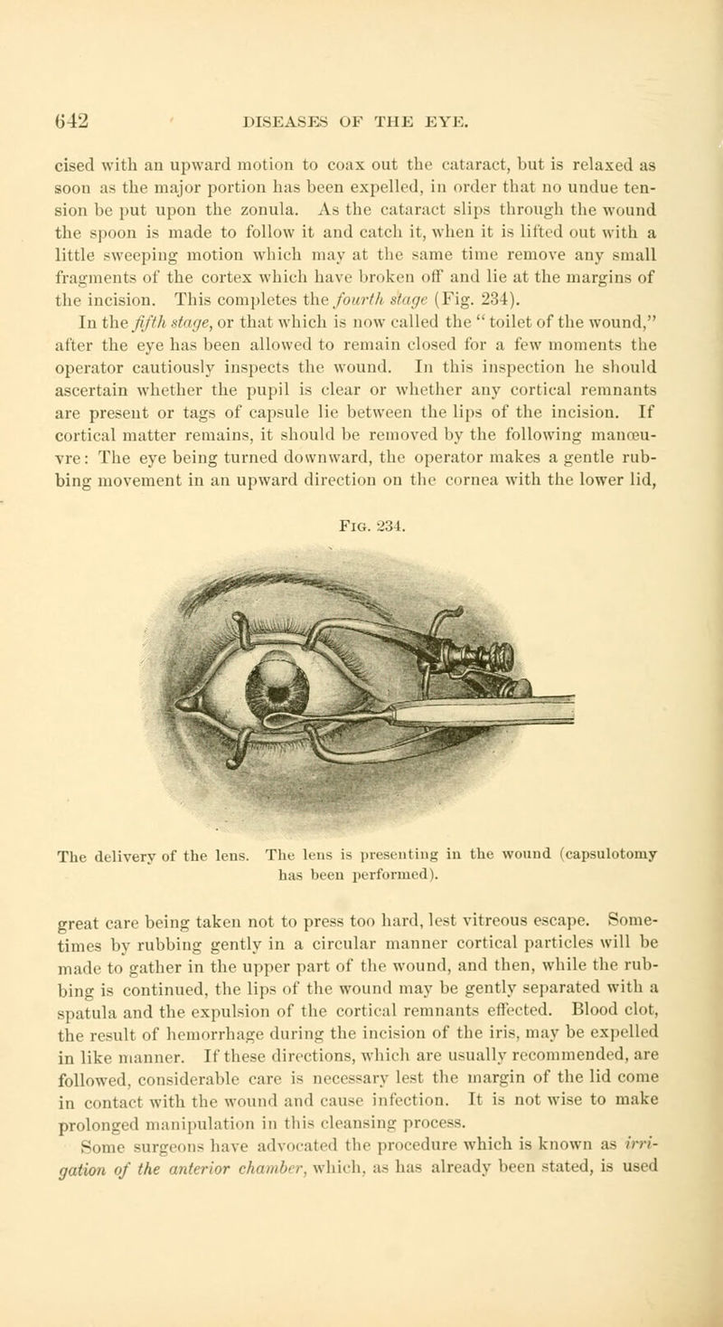 cised with an upward motion to coax out the cataract, but is relaxed as soon as the major portion has been expelled, in order that no undue ten- sion be put upon the zonula. As the cataract slips through the wound the spoon is made to follow it and catch it, when it is lifted out with a little sweeping motion which may at the same time remove any small fragments of the cortex which have broken off and lie at the margins of the incision. This completes the fourth stage ( Fig. 234). in the fifth stage, or that which is now called the  toilet of the wound, after the eye has been allowed to remain closed for a few moments the operator cautiously inspects the wound. In this inspection he should ascertain whether the pupil is clear or whether any cortical remnants are present or tags of capsule lie between the lips of the incision. If cortical matter remains, it should be removed by the following manoeu- vre: The eye being turned downward, the operator makes a gentle rub- bing movement in an upward direction on the cornea with the lower lid, Fig. 234. The delivery of the lens. Tin- lens is presenting in the wound (capsulotomy has been performed). great care being taken not to press too hard, lest vitreous escape. Some- times by rubbing gently in a circular manner cortical particles will be made to gather in the upper part of the wound, and then, while the rub- bing is continued, the lips of the wound may be gently separated with a spatula and the expulsion of the cortical remnants effected. Blood clot, the result of hemorrhage during the incision of the iris, may be expelled in like manner. If these directions, which are usually recommended, are followed, considerable care is necessary Ust the margin of the lid come in contact with the wound and cause infection. It is not wise to make prolonged manipulation in this cleansing process. Some surgeons have advocated the procedure which is known as Irri- gation of the anterior chamber, which, as has already been stated, is used