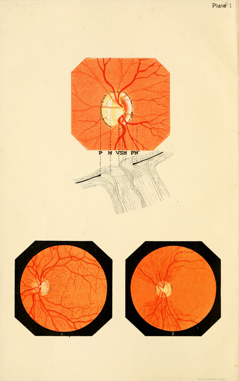 Plate I.