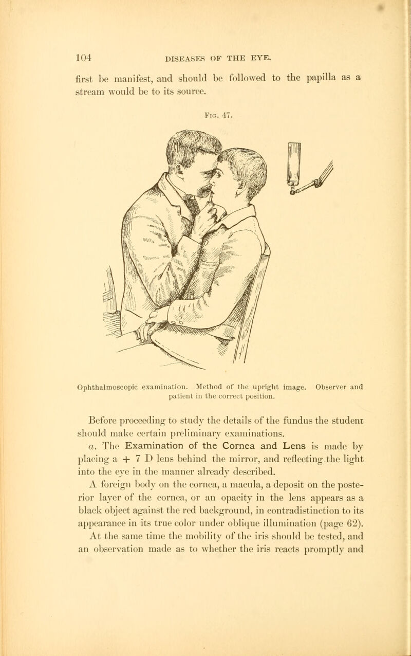 first be manifest, and should be followed to the papilla as a stream would be to its source. Fig. 47. Ophthalmoscopic examination. Method of the upright image. Observer and patient in the correct position. Before proceeding to study the details of the fundus the student should make certain preliminary examinations. a. The Examination of the Cornea and Lens is made by- placing a + 7 D lens behind the mirror, and reflecting the light into the eye in the manner already described. A foreign body on the cornea, a macula, a deposit on the poste- rior layer of the cornea, or an opacity in the lens appears as a black object against the red background, in contradistinction to its appearance in its true color under oblique illumination (page 62). At the same time the mobility of the iris should be tested, and an observation made as to whether the iris reacts promptly and