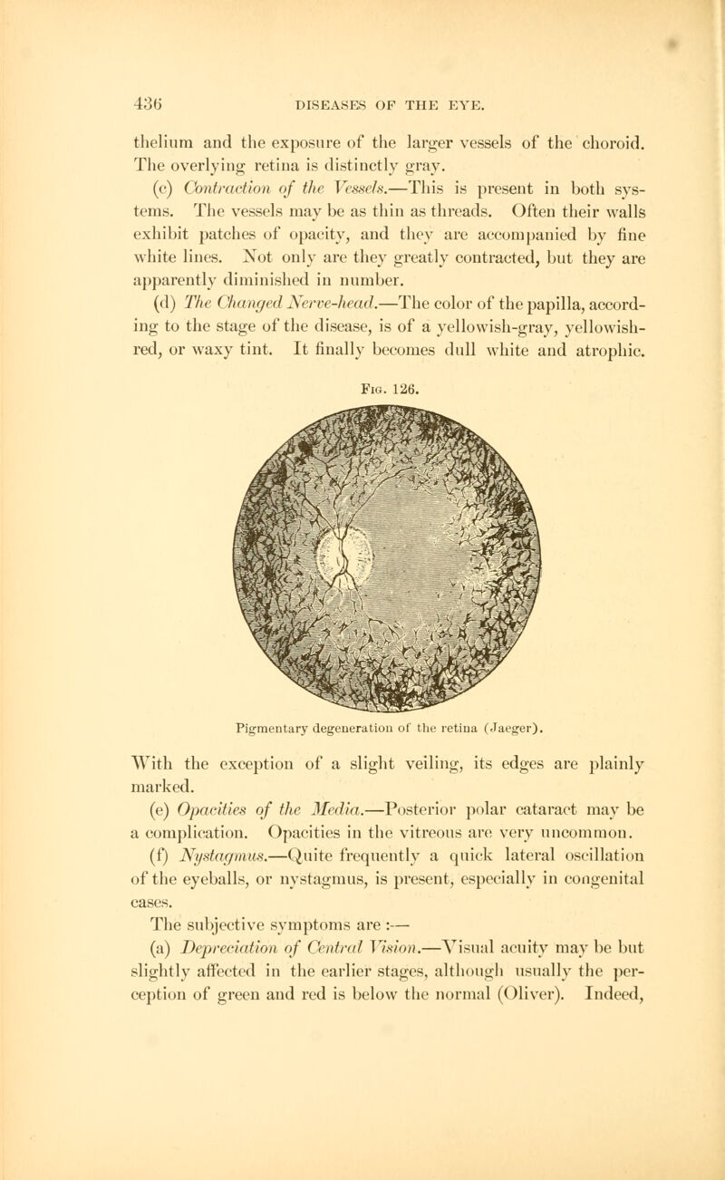 thelium and the exposure of the larger vessels of the choroid. The overlying retina is distinctly gray. (c) Contraction of the Vessels.—This is present in both sys- tems. The vessels may be as thin as threads. Often their walls exhibit patches of opacity, and they are accompanied by fine white lines. Not only are they greatly contracted, but they are apparently diminished in number. (d) The Changed Nerve-head.—The color of the papilla, accord- ing to the stage of the disease, is of a yellowish-gray, yellowish- red, or waxy tint. It finally becomes dull white and atrophic. Fig. 126. Pigmentary degeneration of the retina (Jaeger). With the exception of a slight veiling, its edges are plainly marked. (e) Opacities of the Media.—Posterior polar cataract may be a complication. Opacities in the vitreous are very uncommon. (f) Nystagmus.—Quite frequently a quick lateral oscillation of the eyeballs, or nystagmus, is present, especially in congenital cases. The subjective symptoms are :— (a) Depreciation of Centred Vision.—Visual acuity may be but slightly affected in the earlier stages, although usually the per- ception of green and red is below the normal (Oliver). Indeed,