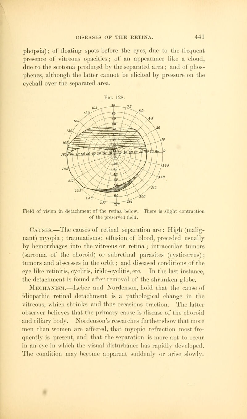 phopsia); of floating spots before the eyes, due to the frequent presence of vitreous opacities; of an appearance like a cloud, due to the scotoma produced by the separated area ; and of phos- phenes, although the latter cannot be elicited by pressure on the eyeball over the separated area. 270 Field of vision in detachment of the retina below. There is slight contraction of the preserved field. Causes.—The causes of retinal separation are : High (malig- nant) myopia; traumatisms; effusion of blood, preceded usually by hemorrhages into the vitreous or retina ; intraocular tumors (sarcoma of the choroid) or subretinal parasites (cysticercus); tumors and abscesses in the orbit; and diseased conditions of the eye like retinitis, cyclitis, irido-cyclitis, etc. In the last instance, the detachment is found after removal of the shrunken globe. Mechanism.—Leber aud Nordenson, hold that the cause of idiopathic retinal detachment is a pathological change in the vitreous, which shrinks and thus occasions traction. The latter observer believes that the primary cause is disease of the choroid and ciliary body. Nordenson's researches further show that more men than women are affected, that myopic refraction most fre- quently is present, and that the separation is more apt to occur in an eye in which the visual disturbance has rapidly developed. The condition may become apparent suddenly or arise slowly.