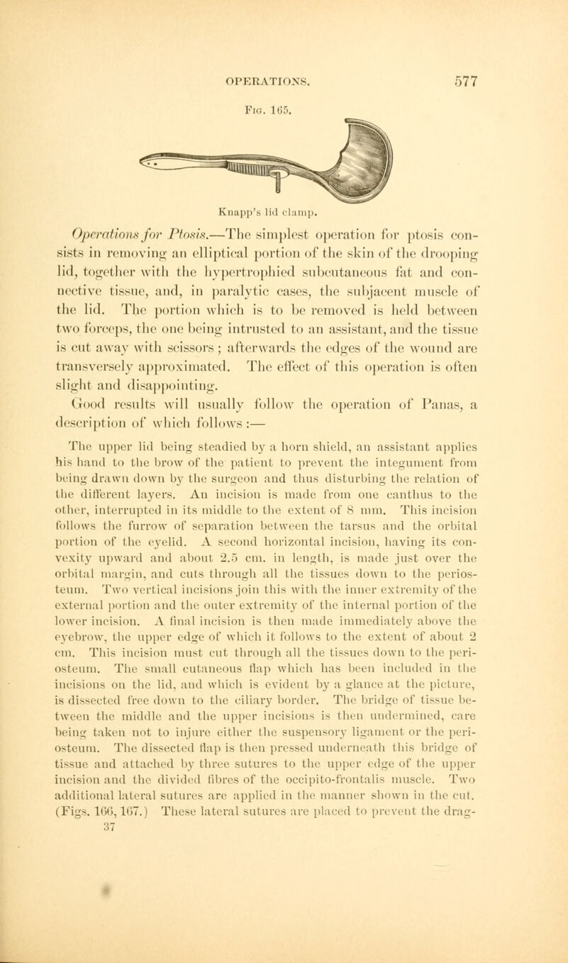 Fig. 165. Knapp's lid clamp. Operations for Ptosis.—The simplest operation for ptosis con- sists in removing an elliptical portion of the skin of the drooping lid, together with the hypertrophied subcutaneous fat and con- nective tissue, and, in paralytic cases, the subjacent muscle of the lid. The portion which is to be removed is held between two forceps, the one being intrusted to an assistant, and the tissue is cut away with scissors; afterwards the edges of the wound are transversely approximated. The effect of this operation is often slight and disappointing. Good results will usually follow the operation of Panas, a description of which follows:— The upper lid being steadied by a horn shield, an assistant applies his hand to the brow of the patient to prevent the integument from being drawn down by the surgeon and thus disturbing the relation of the different layers. An incision is made from one canthus to the other, interrupted in its middle to the extent of 8 mm. This incision follows the furrow of separation between the tarsus and the orbital portion of the eyelid. A second horizontal incision, having its con- vexity upward and about 2.5 cm. in length, is made just over the orbital margin, and cuts through all the tissues down to the perios- teum. Two vertical incisions join this with the inner extremity of the external portion and the outer extremity of the internal portion of the lower incision. A final incision is then made immediately above the eyebrow, the upper edge of which it follows to the extent of about 2 cm. This incision must cut through all the tissues down to the peri- osteum. The small cutaneous flap which has been included in the incisions on the lid, and which is evident by a glance at the picture, is dissected free down to the ciliary border. The bridge of tissue be- tween the middle and the upper incisions is then undermined, care being taken not to injure either the suspensory ligament or the peri- osteum. The dissected flap is then pressed underneath this bridge of tissue and attached by three sutures to the upper edge of the upper incision and the divided fibres of the occipito-frontalis muscle. Two additional lateral sutures are applied in the manner shown in the cut. (Figs. 160,107.) These lateral sutures are placed to prevent the drag- 37