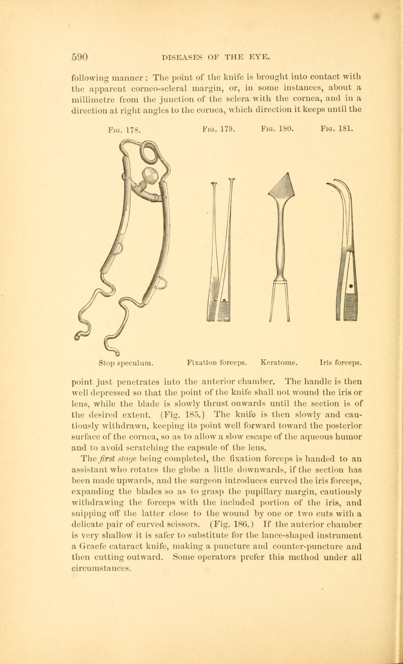 following manner : The point of the knife is brought into contact with the apparent corneo-scleral margin, or, in some instances, about a millimetre from the junction of the sclera with the cornea, and in a direction at right angles to the cornea, which direction it keeps until the Fig. 178. Fig. 179. Fig. 180. Fig. 181. Stop speculum. Fixation forceps. Keratome. Iris forceps. point just penetrates into the anterior chamber. The handle is then well depressed so that the point of the knife shall not wound the iris or lens, while the blade is slowly thrust onwards until the section is of the desired extent. (Fig. 185.) The knife is then slowly and cau- tiously withdrawn, keeping its point well forward toward the posterior surface of the cornea, so as to allow a slow escape of the aqueous humor and to avoid scratching the capsule of the lens. The first stage being completed, the fixation forceps is handed to an assistant who rotates the globe a little downwards, if the section has been made upwards, and the surgeon introduces curved the iris forceps, expanding the blades so as to grasp the pupillary margin, cautiously withdrawing the forceps with the included portion of the iris, and snipping off the latter close to the wound by one or two cuts with a delicate pair of curved scissors. (Fig. 186.) If the anterior chamber is very shallow it is safer to substitute for the lance-shaped instrument a Graefe cataract knife, making a puncture and counter-puncture and then cutting outward. Some operators prefer this method under all circumstances.