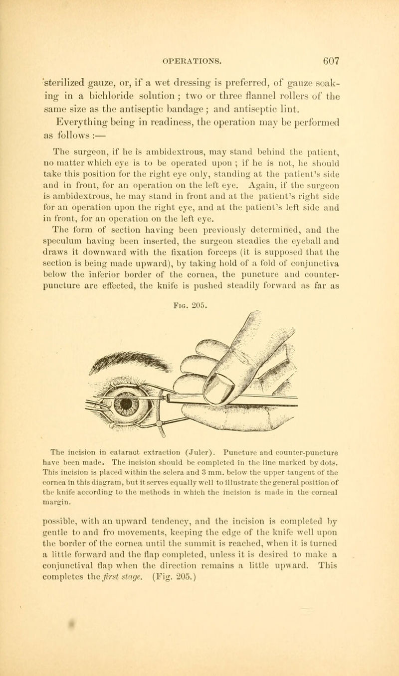 'sterilized gauze, or, if a wet dressing is preferred, of gauze soak- ing in a bichloride solution ; two or three flannel rollers of the same size as the antiseptic bandage; and antiseptic lint. Everything being in readiness, the operation may be performed as follows :— The surgeon, if he is ambidextrous, may stand behind the patient, no matter which eye is to he operated upon ; if he is not, he should take this position for the right eye only, standing at the patient's side and in front, for an operation on the left eye. Again, if the surgeon is ambidextrous, he may stand in frout and at the patient's right side for an operation upon the right eye, and at the patient's left side and in front, for an operation on the left eye. The form of section having been previously determined, and the speculum having been inserted, the surgeon steadies the eyeball and draws it downward with the fixation forceps (it is supposed that the section is being made upward), by taking hold of a fold of conjunctiva below the inferior border of the cornea, the puncture and counter- puncture are effected, the knife is pushed steadily forward as far as Fig. 205. The incision in cataract extraction (Juler). Puncture and counter-puncture have been made. The incision should be completed in the line marked by dots. This incision is placed within the 6clera and 3 mm. below the upper tangent of the cornea in this diagram, but it serves equally well to illustrate the general position of the knife according to the methods in which the incision is made in the corneal margin. possible, with an upward tendency, and the incision is completed by gentle to and fro movements, keeping the edge of the knife well upon tbi' border of the cornea until the summit is reached, when it is turned a little forward and the flap completed, unless it is desired to make a conjunctival flap when the direction remains a little upward. This completes the first stage. (Fig. 205.)