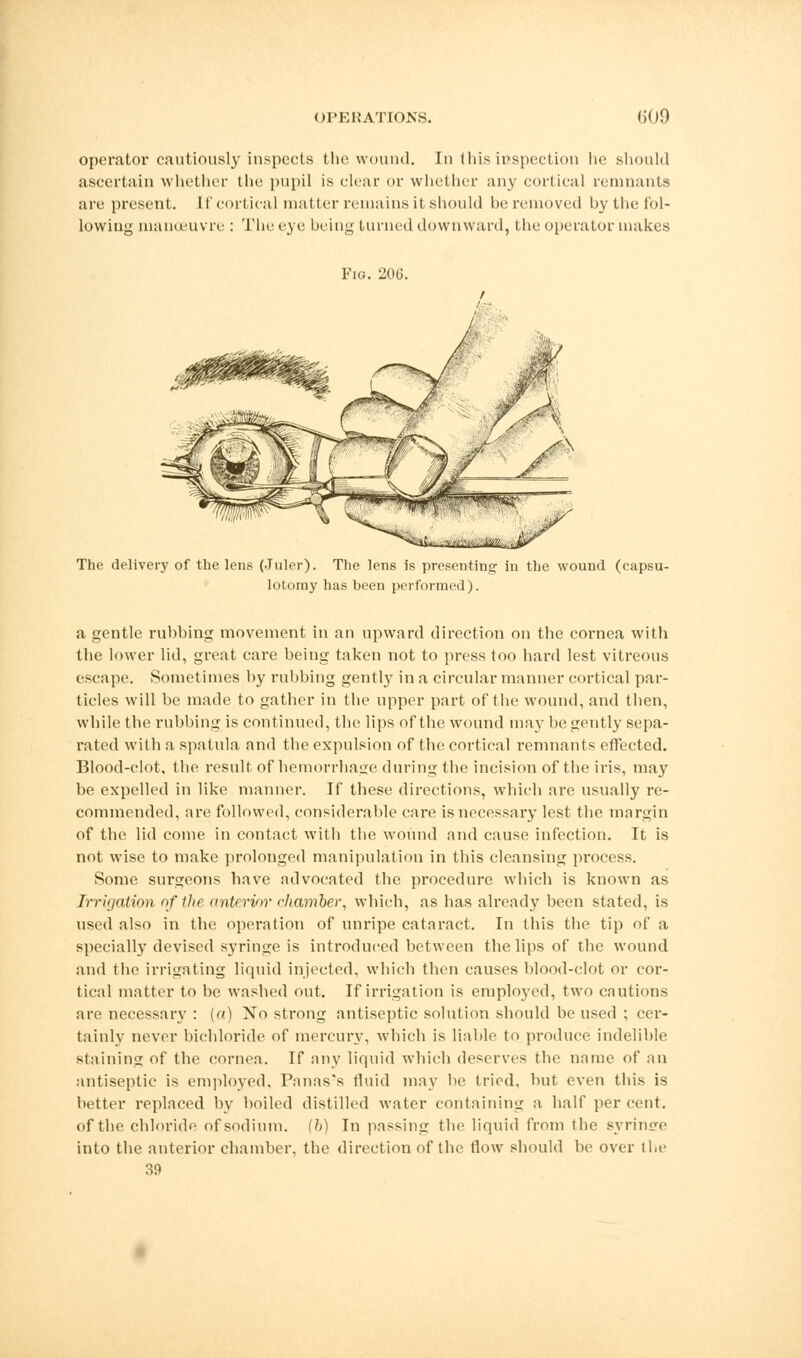 operator cautiously inspects the wound. In this inspection lie should ascertain whether the pupil is clear or whether any cortical remnants are present. If cortical matter remains it should be removed hy the fol- lowing manoeuvre : The eye being turned downward, the operator makes Fig. 206. The delivery of the lens (Juler). The lens is presenting in the wound (capsu- lotomy has been performed). a gentle rubbing movement in an upward direction on the cornea with the lower lid, great care being taken not to press too hard lest vitreous escape. Sometimes by rubbing gentty in a circular manner cortical par- ticles will be made to gather in the upper part of the wound, and then, while the rubbing is continued, the lips of the wound may be gently sepa- rated with a spatula and the expulsion of the cortical remnants effected. Blood-clot, the result of hemorrhage during the incision of the iris, may be expelled in like manner. If these directions, which are usually re- commended, are followed, considerable enre is necessary lest the margin of the lid come in contact with the wound and cause infection. It is not wise to make prolonged manipulation in this cleansing process. Some sui'geons have advocated the procedure which is known as Irrigation of the anterior chamber, which, as has already been stated, is used also in the operation of unripe cataract. In this the tip of a specially devised syringe is introduced between the lips of the wound and the irrigating liquid injected, which then causes blood-clot or cor- tical matter to be washed out. If irrigation is employed, two cautions are necessary : («) No strong antiseptic solution should be used ; cer- tainly never bichloride of mercury, which is liable to produce indelible staining of the cornea. If any liquid which deserves the name of an antiseptic is employed, Panas's fluid may be tried, but even this is better replaced by boiled distilled water containing a half per cent, of the chloride of sodium. (6) In passing the liquid from the syrince into the anterior chamber, the direction of the flow should be over the 39