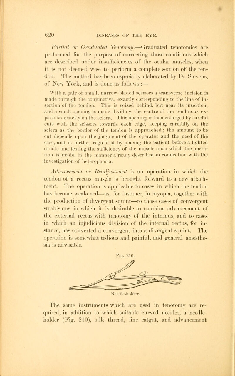 Partial or Graduated Tenotomy.—Graduated tenotomies are performed for the purpose of correcting those conditions which are described under insufficiencies of the ocular muscles, when it is not deemed wise to perform a complete section of the ten- don. The method has been especially elaborated by Dr. Stevens, of New York, and is done as follows :— With a pair of small, narrow-bladed scissors a transverse incision is made through the conjunctiva, exactly corresponding to the line of in- sertion of the tendon. This is seized behind, but near its insertion, and a small opening is made dividing the centre of the tendinous ex- pansion exactly on the sclera. This opening is then enlarged by careful cuts with the scissors towards each edge, keeping carefully on the sclera as the border of the tendon is approached ; the amount to be cut depends upon the judgment of the operator and the need of the case, and is further regulated by placing the patient before a lighted candle and testing the sufficiency of the muscle upon which the opera- tion is made, in the manner already described in connection with the investigation of heterophoria. Advancement or Readjustment is an operation in which the tendon of a rectus muscle is brought forward to a new attach- ment. The operation is applicable to cases in which the tendon has become weakened—as, for instance, in myopia, together with the production of divergent squint—to those cases of convergent strabismus in which it is desirable to combine advancement of the external rectus with tenotomy of the internus, and to cases in which an injudicious division of the internal rectus, for in- stance, has converted a convergent into a divergent squint. The operation is somewhat tedious and painful, and general anaesthe- sia is advisable. Fig. 210. Needle-hoUler. The same instruments which are used in tenotomy are re- quired, in addition to which suitable curved needles, a needle- holder (Fig. 210), silk thread, fine catgut, and advancement