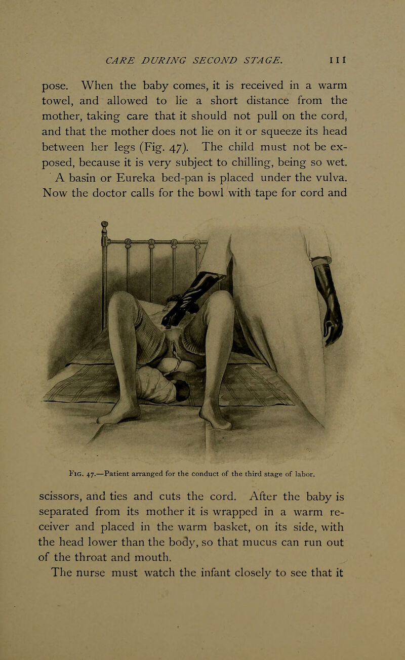 pose. When the baby comes, it is received in a warm towel, and allowed to lie a short distance from the mother, taking care that it should not pull on the cord, and that the mother does not lie on it or squeeze its head between her legs (Fig. 47). The child must not be ex- posed, because it is very subject to chilling, being so wet. A basin or Eureka bed-pan is placed under the vulva. Now the doctor calls for the bowl with tape for cord and Fig. 47.—Patient arranged for the conduct of the third stage of labor. scissors, and ties and cuts the cord. After the baby is separated from its mother it is wrapped in a warm re- ceiver and placed in the warm basket, on its side, with the head lower than the body, so that mucus can run out of the throat and mouth. The nurse must watch the infant closely to see that it