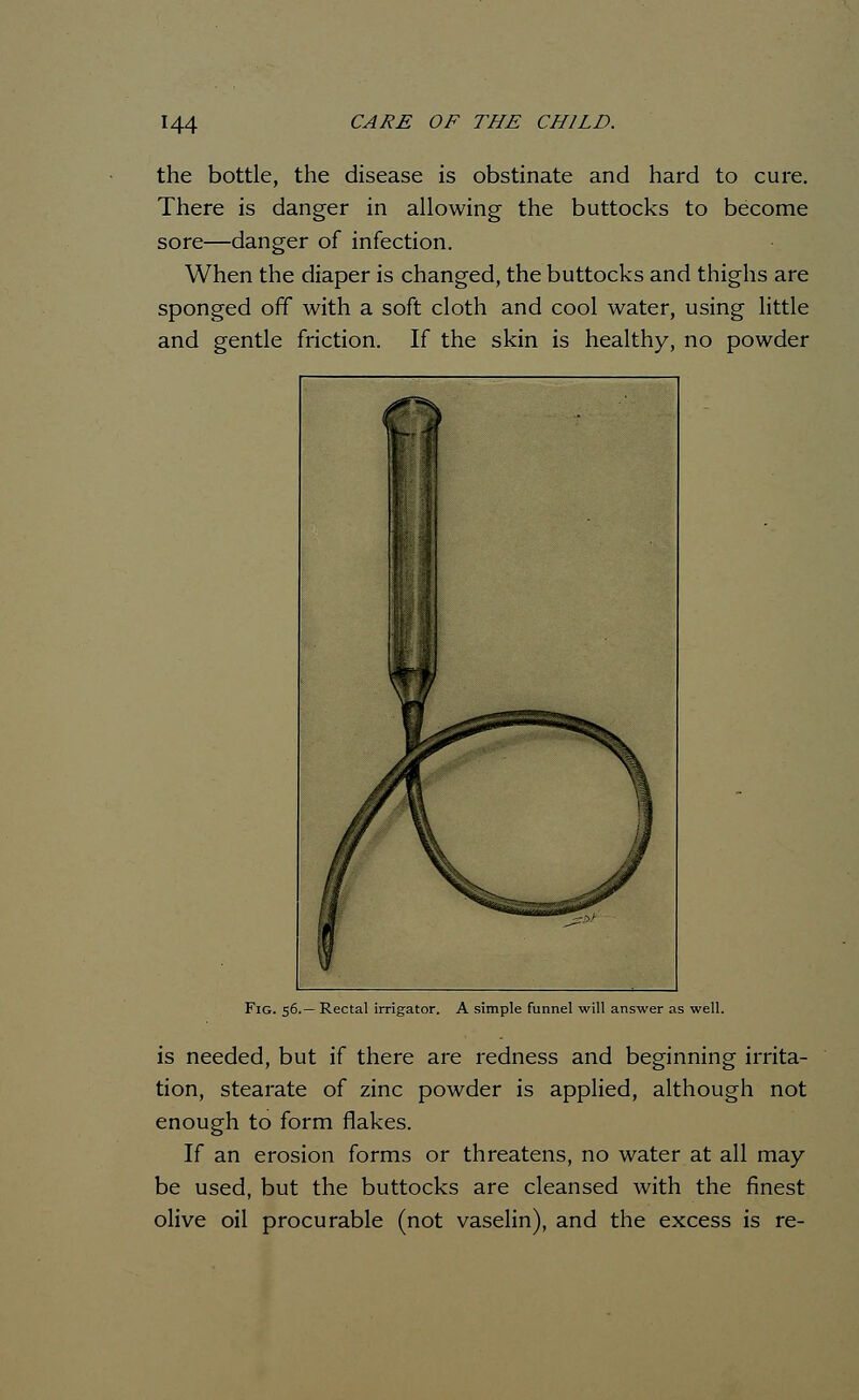 the bottle, the disease is obstinate and hard to cure. There is danger in allowing the buttocks to become sore—danger of infection. When the diaper is changed, the buttocks and thighs are sponged off with a soft cloth and cool water, using little and gentle friction. If the skin is healthy, no powder Fig. 56.— Rectal irrigator. A simple funnel will answer as well. is needed, but if there are redness and beginning irrita- tion, stearate of zinc powder is applied, although not enough to form flakes. If an erosion forms or threatens, no water at all may- be used, but the buttocks are cleansed with the finest olive oil procurable (not vaselin), and the excess is re-