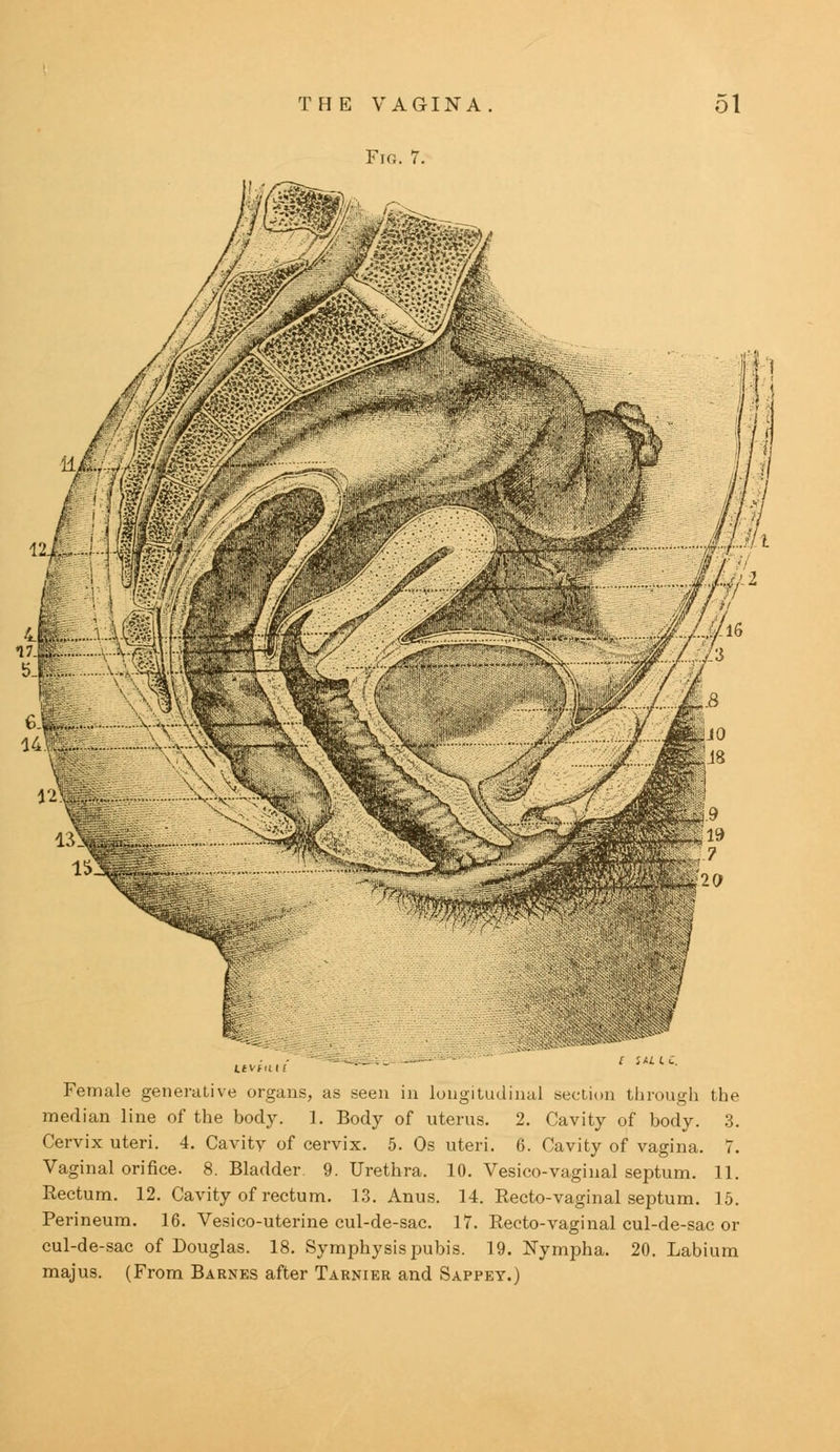 THE VAGINA. Fia. 7. 51 Female generative organs, as seen in longitudinal section through the median line of the body. 1. Body of uterus. 2. Cavity of body. 3. Cervix uteri. 4. Cavity of cervix. 5. Os uteri. 6. Cavity of vagina. 7. Vaginal orifice. 8. Bladder 9. Urethra. 10. Vesico-vaginal septum. 11. Rectum. 12. Cavity of rectum. 13. Anus. 14. Recto-vaginal septum. 15. Perineum. 16. Vesico-uterine cul-de-sac. 17. Recto-vaginal cul-de-sac or cul-de-sac of Douglas. 18. Symphysis pubis. 19. ISTympha. 20. Labium majus. (From Barnes after Tarnier and Sappey.)