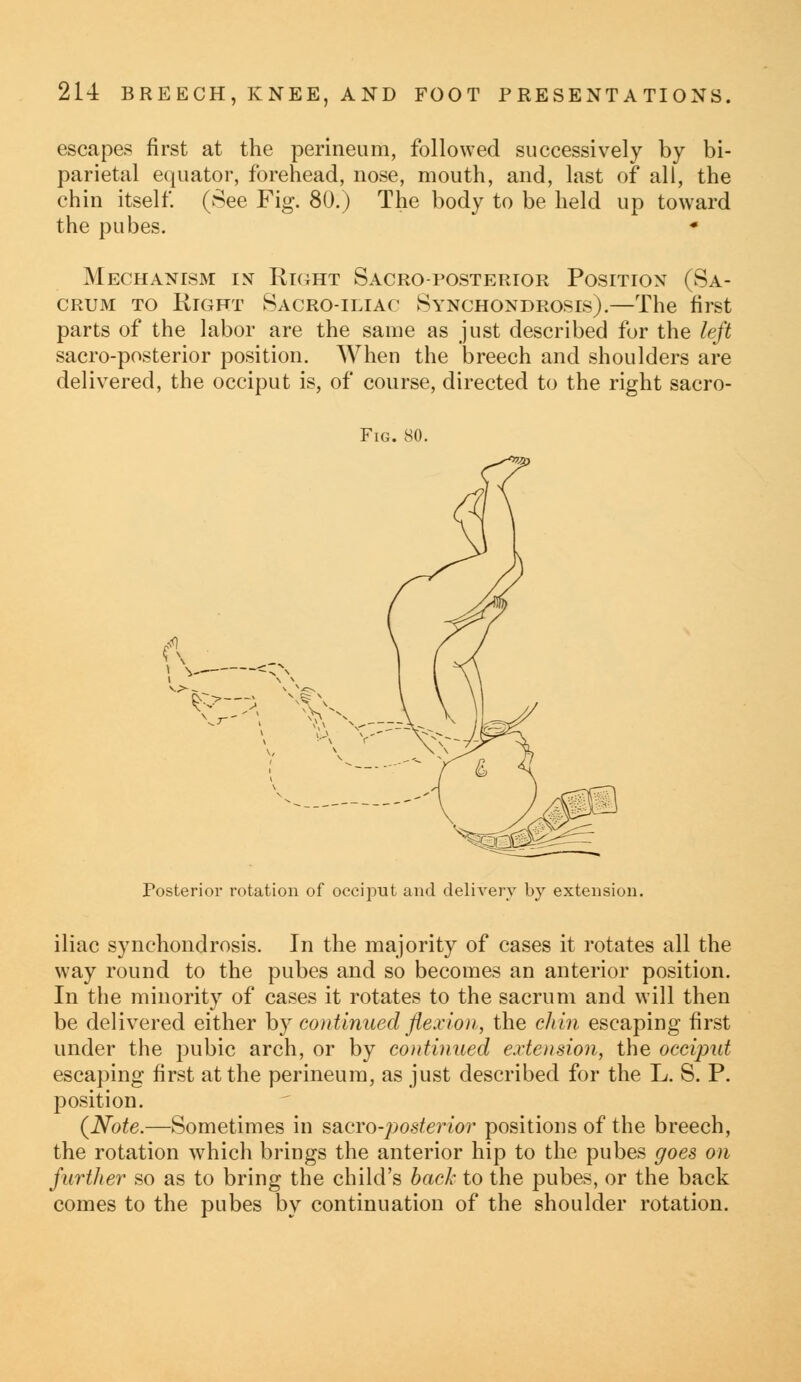 escapes first at the perineum, followed successively by bi- parietal equator, forehead, nose, mouth, and, last of all, the chin itself. (See Fig. 80.) The body to be held up toward the pubes. Mechanism in Right Sacroposterior Position (Sa- crum to Right Sacro-iliac Synchondrosis).—The first parts of the labor are the same as just described for the left sacro-posterior position. When the breech and shoulders are delivered, the occiput is, of course, directed to the right sacro- Fig. 80. Posterior rotation of occiput and delivery by extension. iliac synchondrosis. In the majority of cases it rotates all the way round to the pubes and so becomes an anterior position. In the minority of cases it rotates to the sacrum and will then be delivered either by continued flexion, the chin escaping first under the pubic arch, or by continued extension, the occiput escaping first at the perineum, as just described for the L. S. P. position. (Note.—Sometimes in sacro-posterior positions of the breech, the rotation w7hich brings the anterior hip to the pubes goes on further so as to bring the child's back to the pubes, or the back comes to the pubes by continuation of the shoulder rotation.