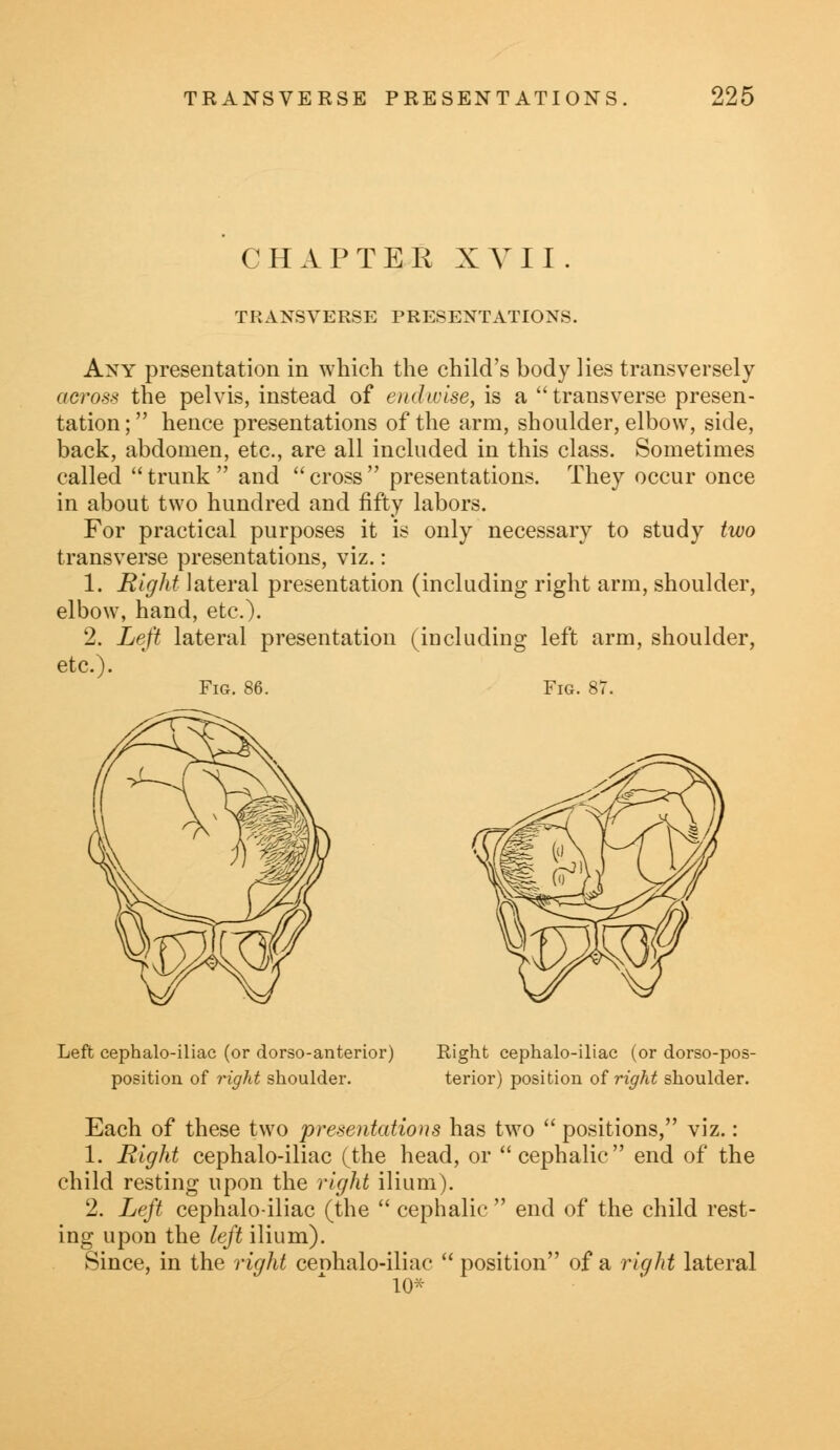 CHAPTER XVII. TRANSVERSE PRESENTATIONS. Any presentation in which the child's body lies transversely across the pelvis, instead of endwise, is a transverse presen- tation ; hence presentations of the arm, shoulder, elbow, side, back, abdomen, etc., are all included in this class. Sometimes called trunk and cross presentations. They occur once in about two hundred and fifty labors. For practical purposes it is only necessary to study two transverse presentations, viz.: 1. Eight lateral presentation (including right arm, shoulder, elbow, hand, etc.). 2. Left lateral presentation (including left arm, shoulder, etc.). Fig. 86. Fig. 87. Left cephalo-iliac (or dorso-anterior) position of right shoulder. Right cephalo-iliac (or dorso-pos- terior) position of right shoulder. Each of these two presentations has two  positions, viz.: 1. Right cephalo-iliac (the head, or cephalic end of the child resting upon the right ilium). 2. Left cephalo-iliac (the  cephalic  end of the child rest- ing upon the left ilium). Since, in the right ceohalo-iliac  position of a right lateral 10*