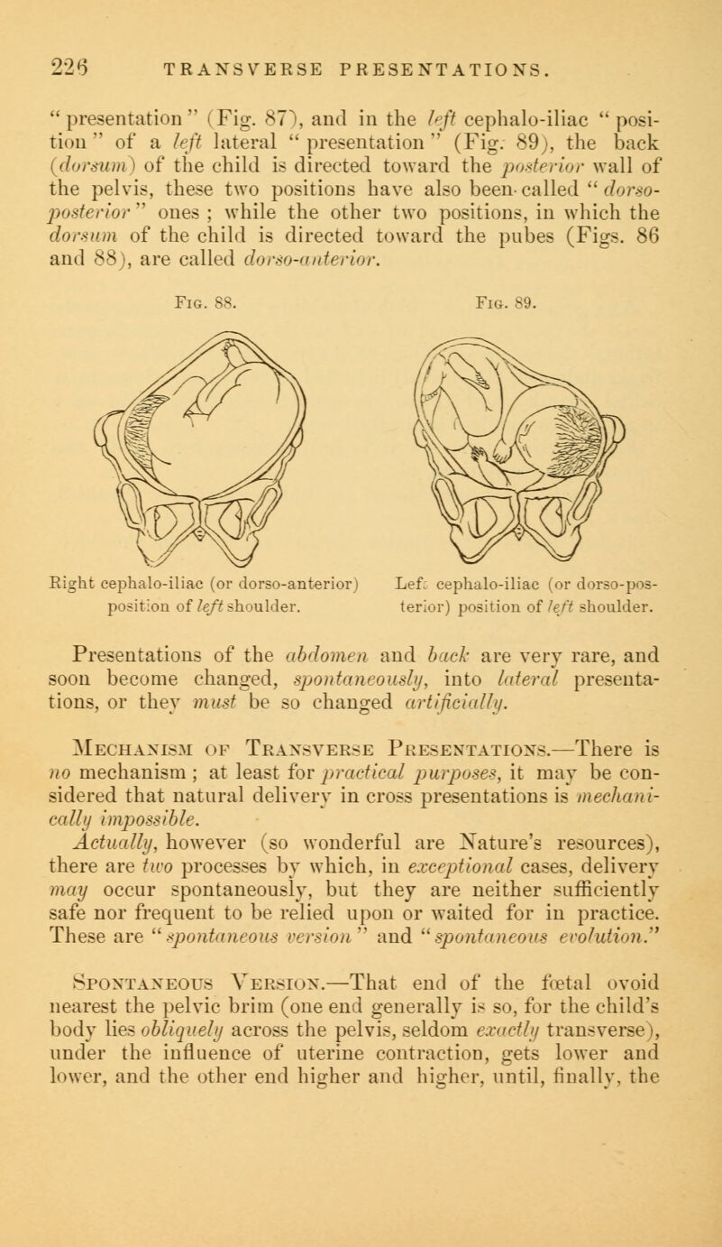 presentation (Fig. 87), and in the left cephalo-iliac  posi- tion  of a left lateral  presentation  (Fig. 89), the back dorsum) of the child is directed toward the posterior wall of the pelvis, these two positions have also been- called  dorso- posterior  ones ; while the other two positions, in which the dorsum of the child is directed toward the pubes (Figs. 86 and <s-^ >, are called dorso-onterior. Fig. 88. Fig. 89. Right cephalo-iliac (or dorso-anterior position of left shoulder. Left cephalo-iliac (or dorso-pos- terior) position of left shoulder. Presentations of the abdomen and back are very rare, and soon become changed, spontaneously, into lateral presenta- tions, or they must be so changed artificially. Mechanism of Transverse Presentations.—There is no mechanism; at least for practical purposes, it may be con- sidered that natural delivery in cross presentations is mechani- cally impossible. Actually, however (so wonderful are Nature's resources), there are two processes by which, in exceptional cases, delivery may occur spontaneously, but they are neither sufficiently safe nor frequent to be relied upon or waited for in practice. These are spontaneous version and spontaneous evolution. Spontaneous Version.—That end of the foetal ovoid nearest the pelvic brim (one end generally is so, for the child's body lies obliquely across the pelvis, seldom exactly transverse), under the influence of uterine contraction, gets lower and lower, and the other end higher and higher, until, finally, the