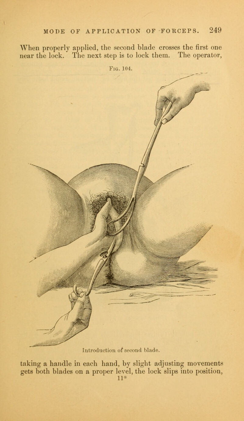 When properly applied, the second blade crosses the first one near the lock. The next step is to lock them. The operator, Fig. 104. Introduction of second blade. taking a handle in each hand, by slight adjusting movements gets both blades on a proper level, the lock slips into position, 11*