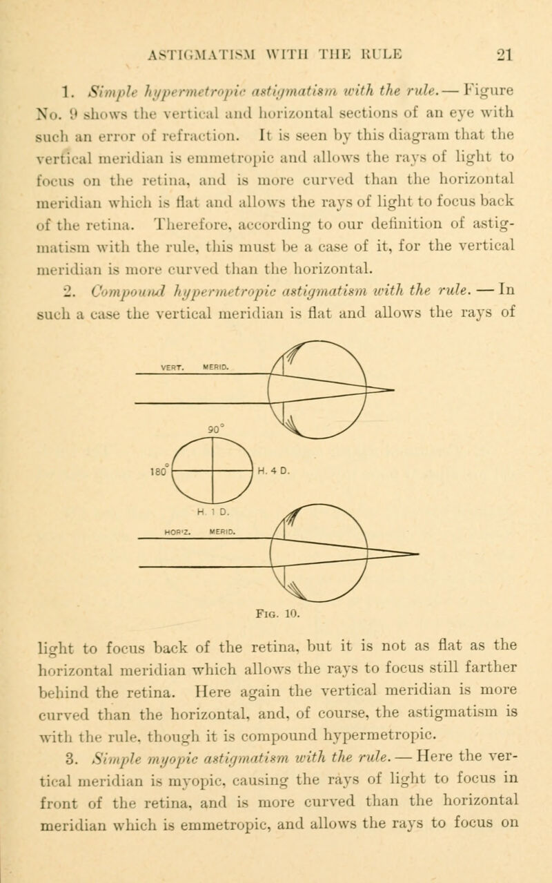 1. Simple hypermetropic astigmatism with the rule.— Figure No. 9 shows the vertical and horizontal sections of an eye with siu-li an error of refraction. It is seen by this diagram that the vertical meridian is emmetropic and allows the rays of light to torus on the retina, and is more curved than the horizontal meridian which is flat and allows the rays of light to focus back of the retina. Therefore, according to our definition of astig- matism with the rule, this must be a case of it, for the vertical meridian is more curved than the horizontal. •1. Compound hypermetropic astigmatism with the rule. — In such a case the vertical meridian is flat and allows the rays of light to focus hack of the retina, but it is not as flat as the horizontal meridian which allows the rays to focus still farther behind the retina. Here again the vertical meridian is more curved than the horizontal, and. of course, the astigmatism is with the rule, though it is compound hypermetropic. 3. Simple myopic astigmatism with the rule. — Here the ver- tical meridian is myopic, causing the rays of light to focus in front of the retina, and is more curved than the horizontal meridian which is emmetropic, and allows the rays to focus on