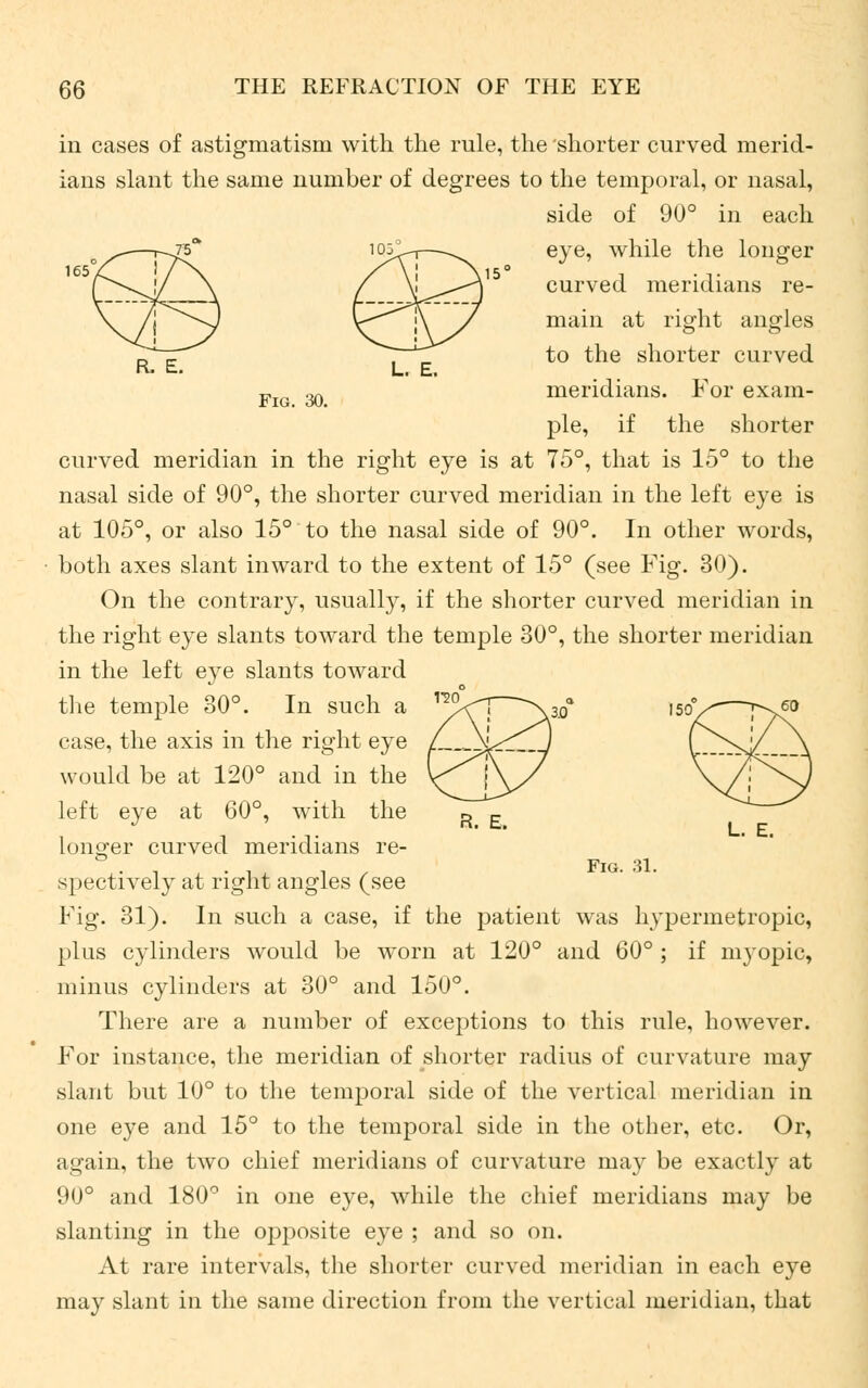 FL E. L. E. Fig. 30. in cases of astigmatism with the rule, the shorter curved merid- ians slant the same number of degrees to the temporal, or nasal, side of 90° in each eye, while the longer curved meridians re- main at right angles to the shorter curved meridians. For exam- ple, if the shorter curved meridian in the right eye is at 75°, that is 15° to the nasal side of 90°, the shorter curved meridian in the left eye is at 105°, or also 15° to the nasal side of 90°. In other words, both axes slant inward to the extent of 15° (see Fig. 30). On the contrary, usually, if the shorter curved meridian in the right eye slants toward the temple 30°, the shorter meridian in the left eye slants toward the temple 30°. In such a case, the axis in the right eye would be at 120° and in the left eye at 60°, with the longer curved meridians re- spectively at right angles (see Fig. 31). In such a case, if the patient was hypermetropic, plus cylinders would be worn at 120° and 60° ; if myopic, minus cylinders at 30° and 150°. There are a number of exceptions to this rule, however. For instance, the meridian of shorter radius of curvature may slant but 10° to the temporal side of the vertical meridian in one eye and 15° to the temporal side in the other, etc. Or, again, the two chief meridians of curvature may be exactly at 90° and 180° in one eye, while the chief meridians may be slanting in the opposite eye ; and so on. At rare intervals, the shorter curved meridian in each eye may slant in the same direction from the vertical meridian, that L. E. Fig. 31.